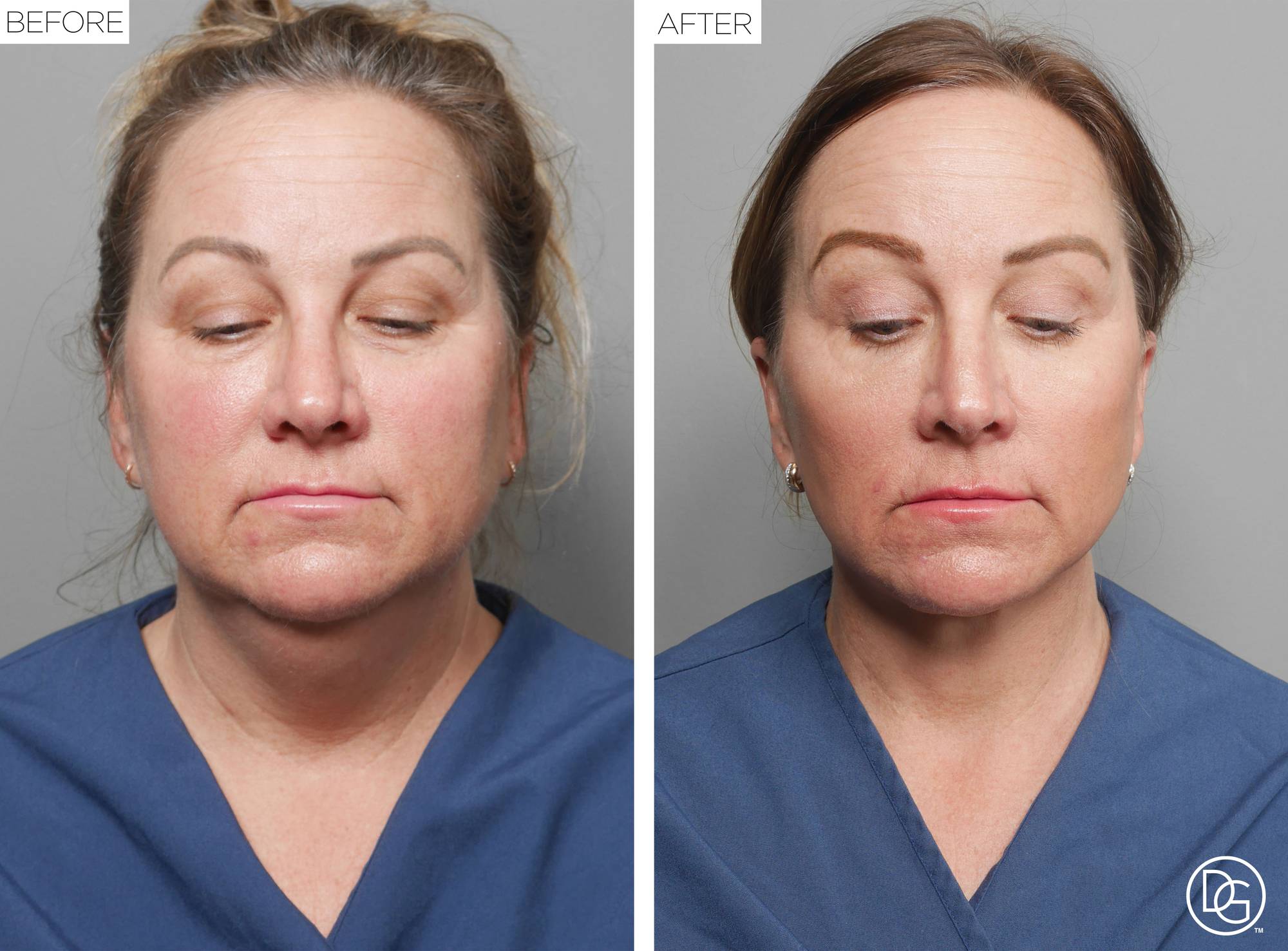 Before & After Image