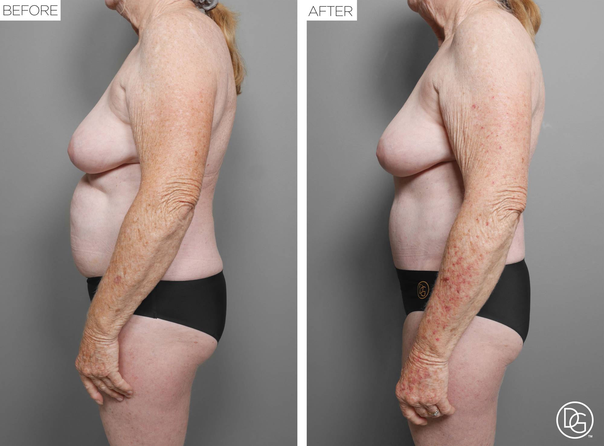 Before & After Image