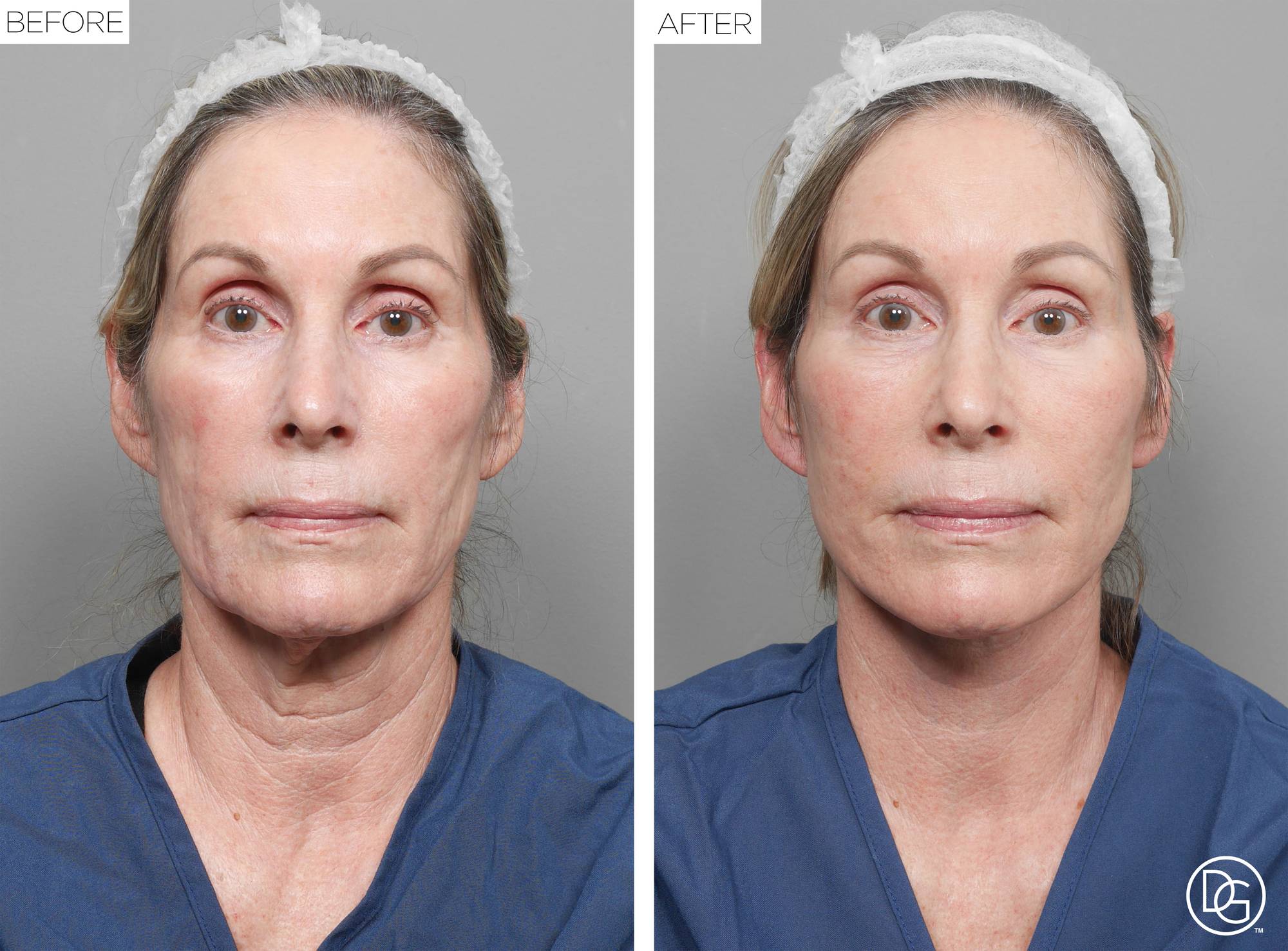 Before & After Image