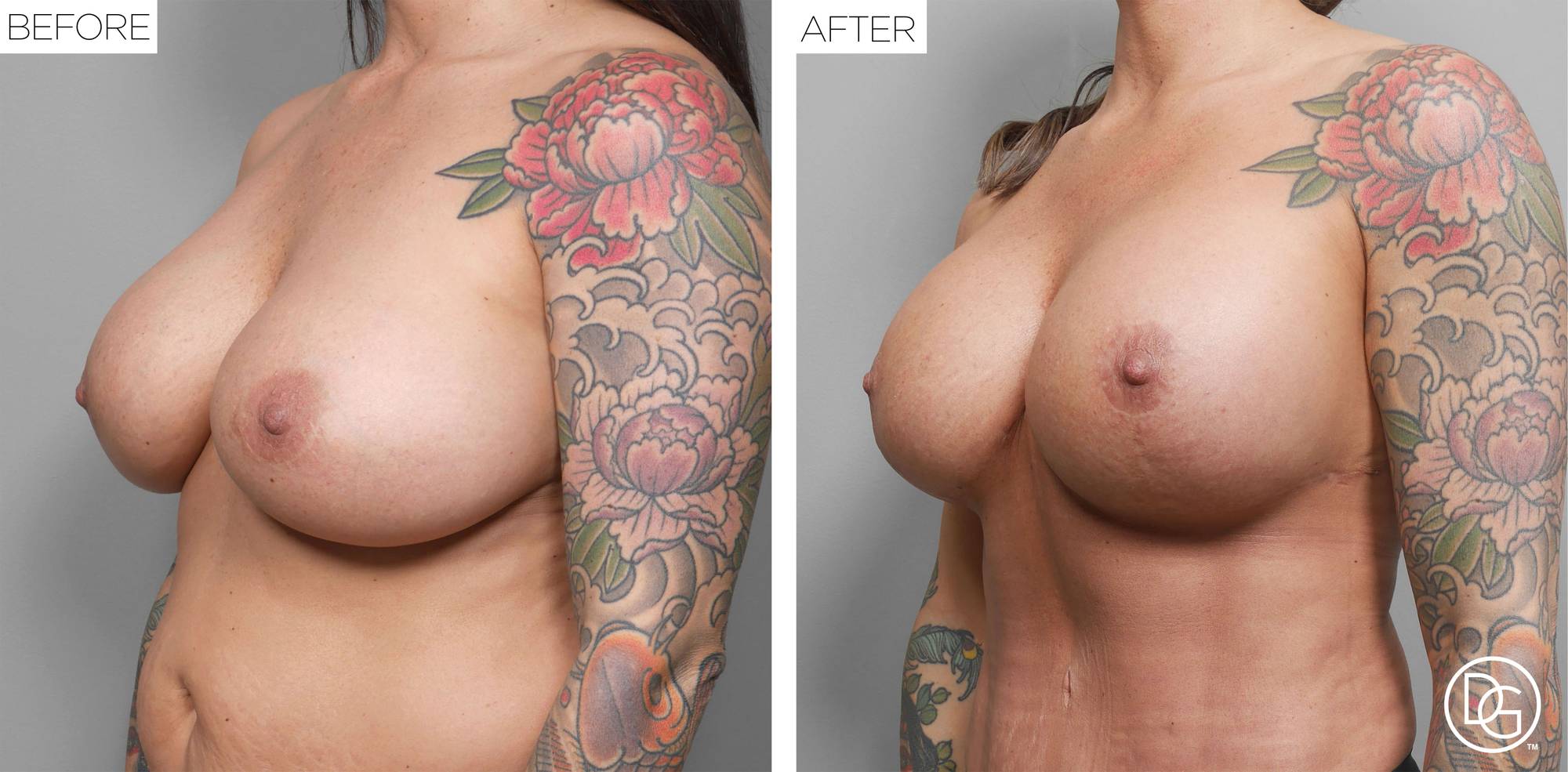 Before & After Image