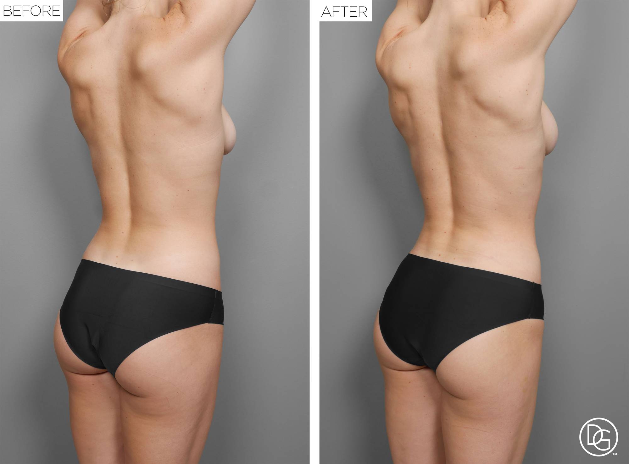 Before & After Image