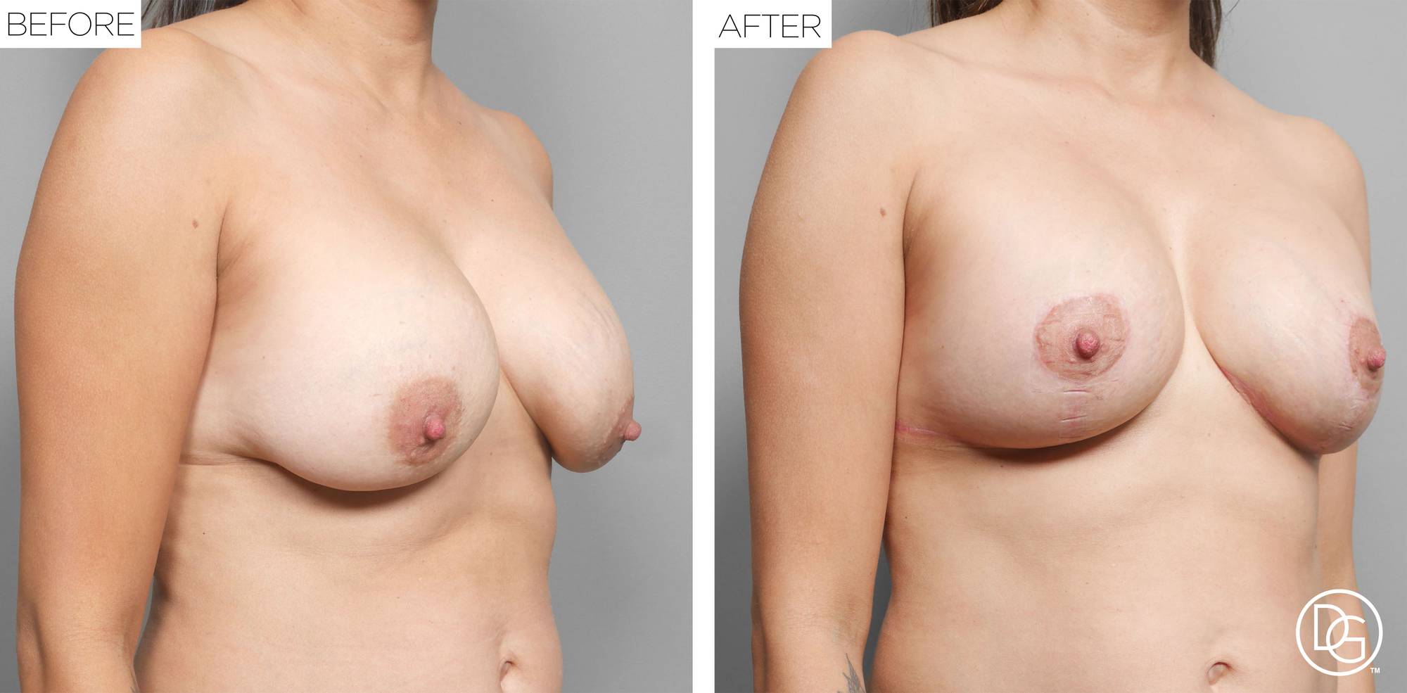 Before & After Image