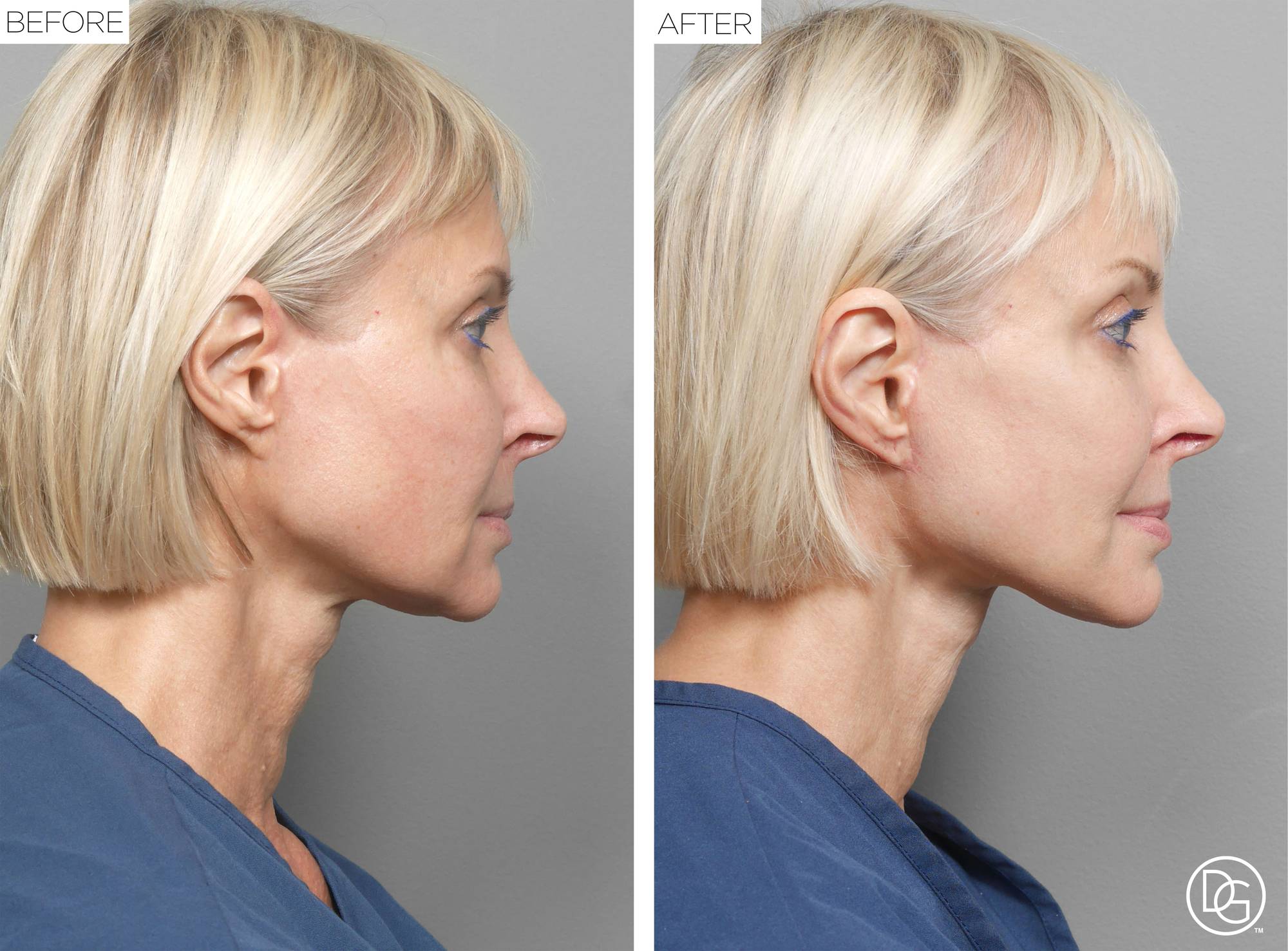 Before & After Image