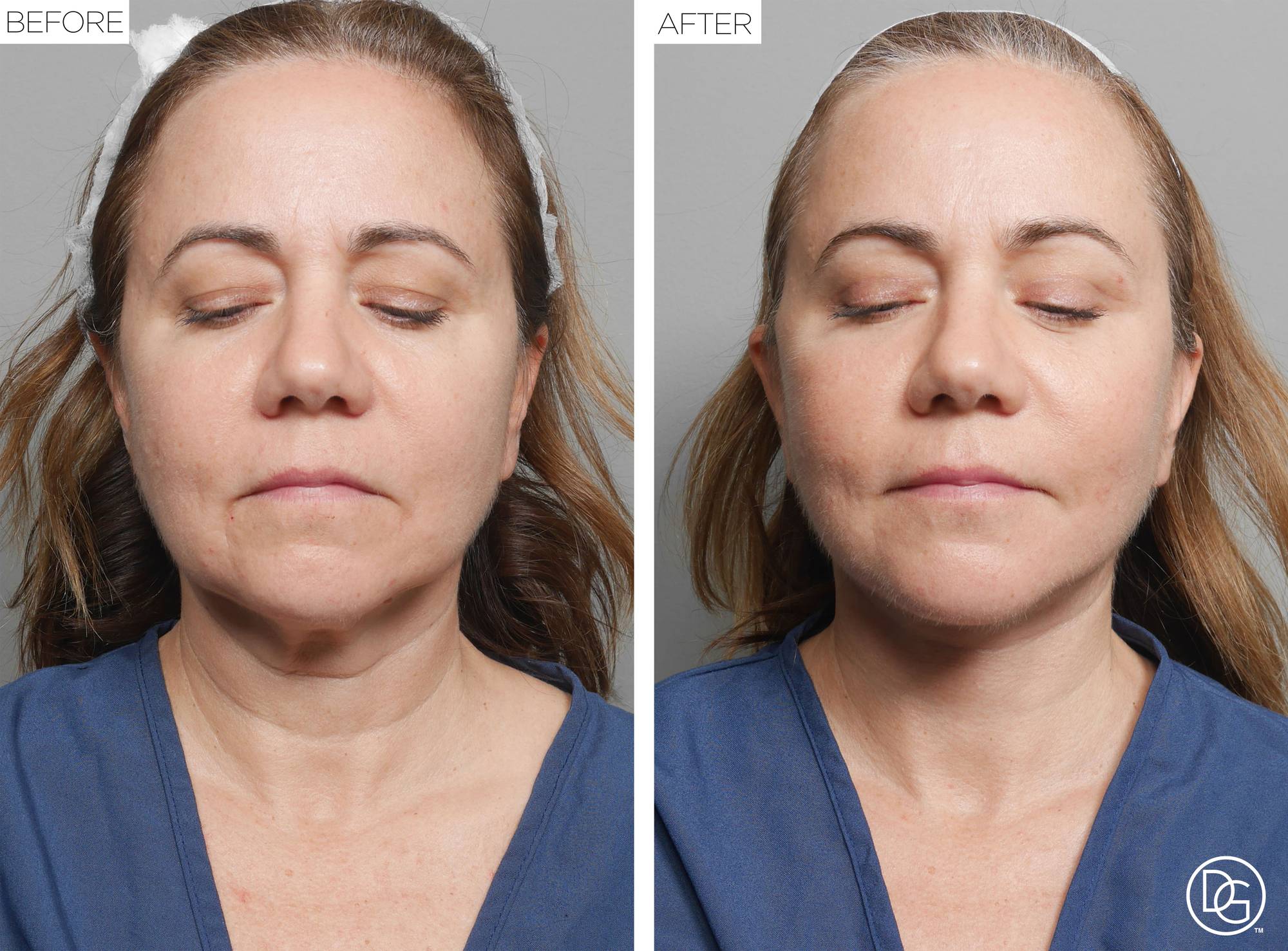 Before & After Image