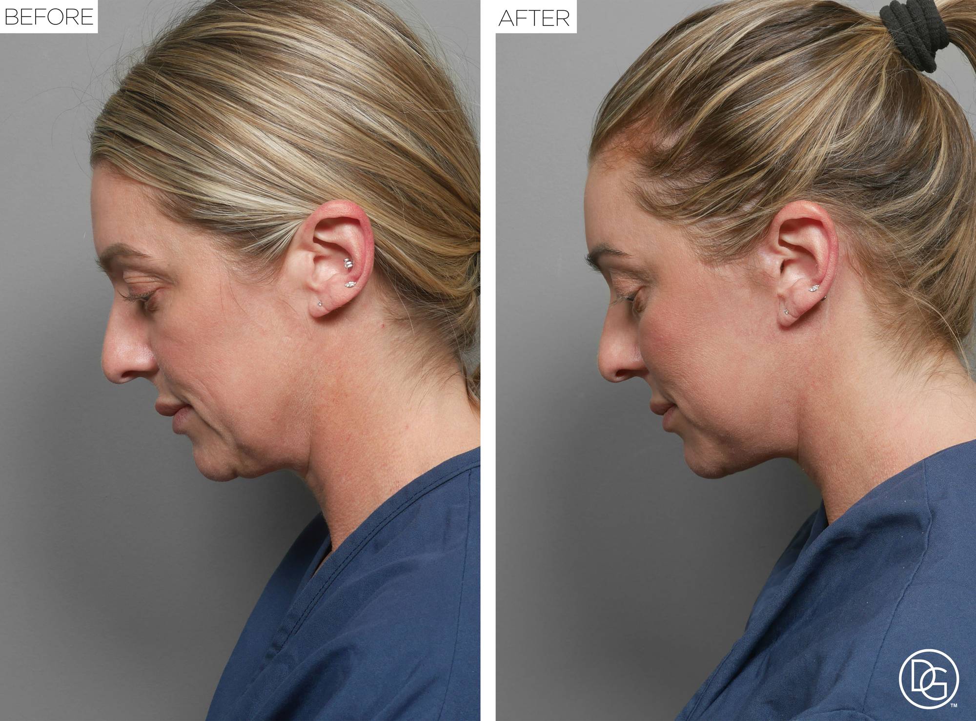Before & After Image