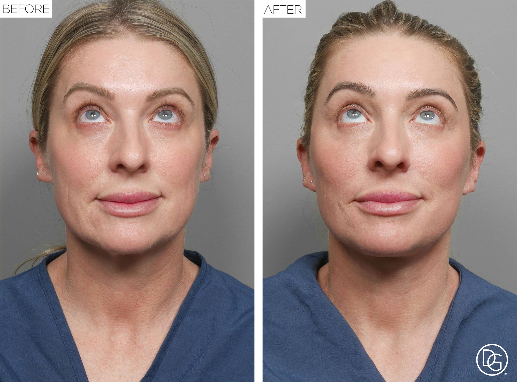 Before & After Image