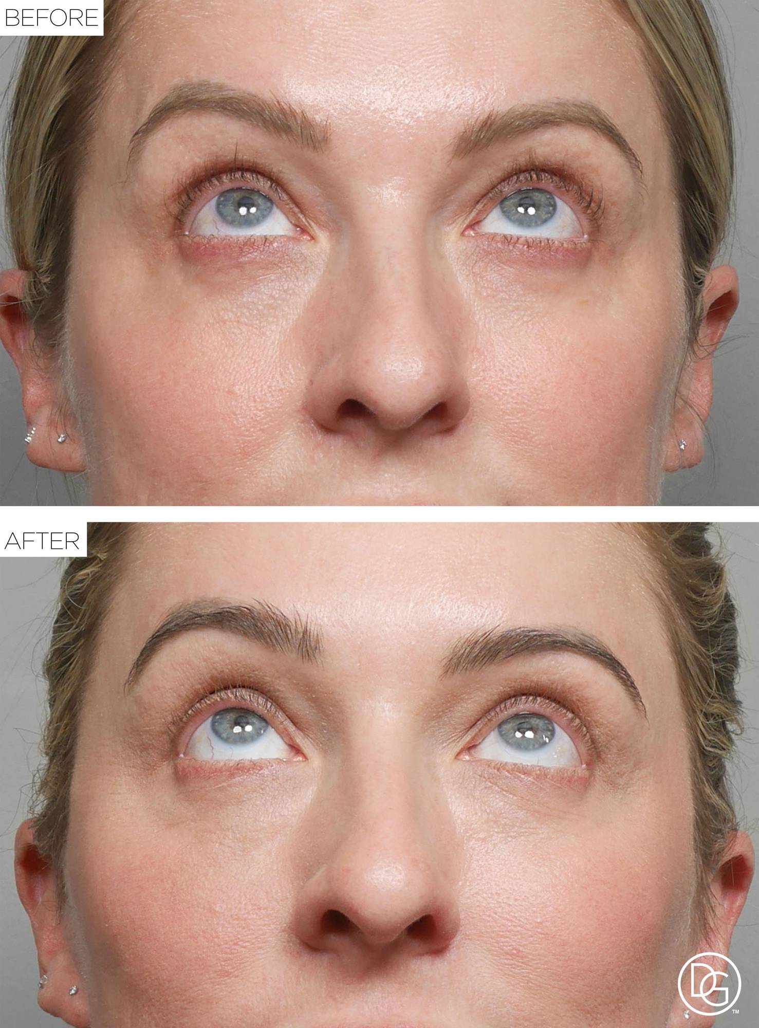 Before & After Image