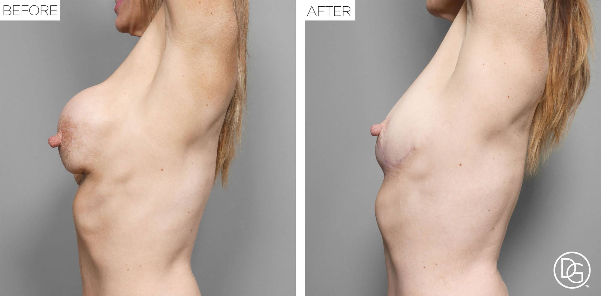 Before & After Image