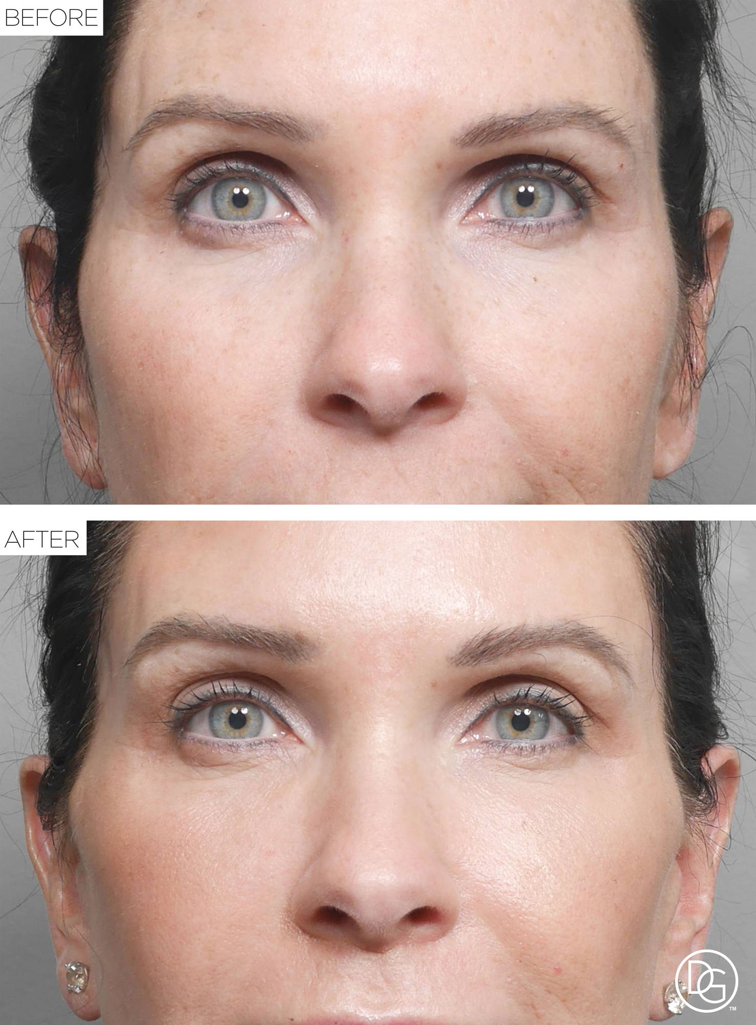Before & After Image