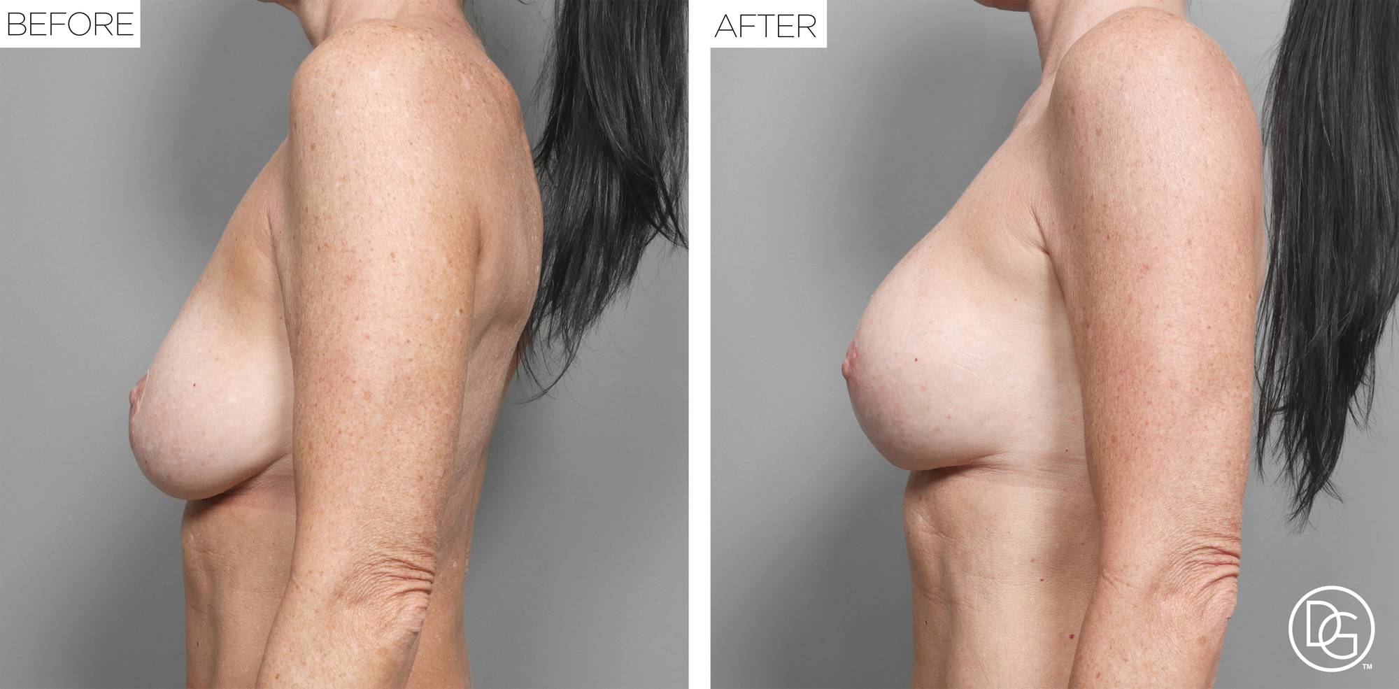 Before & After Image
