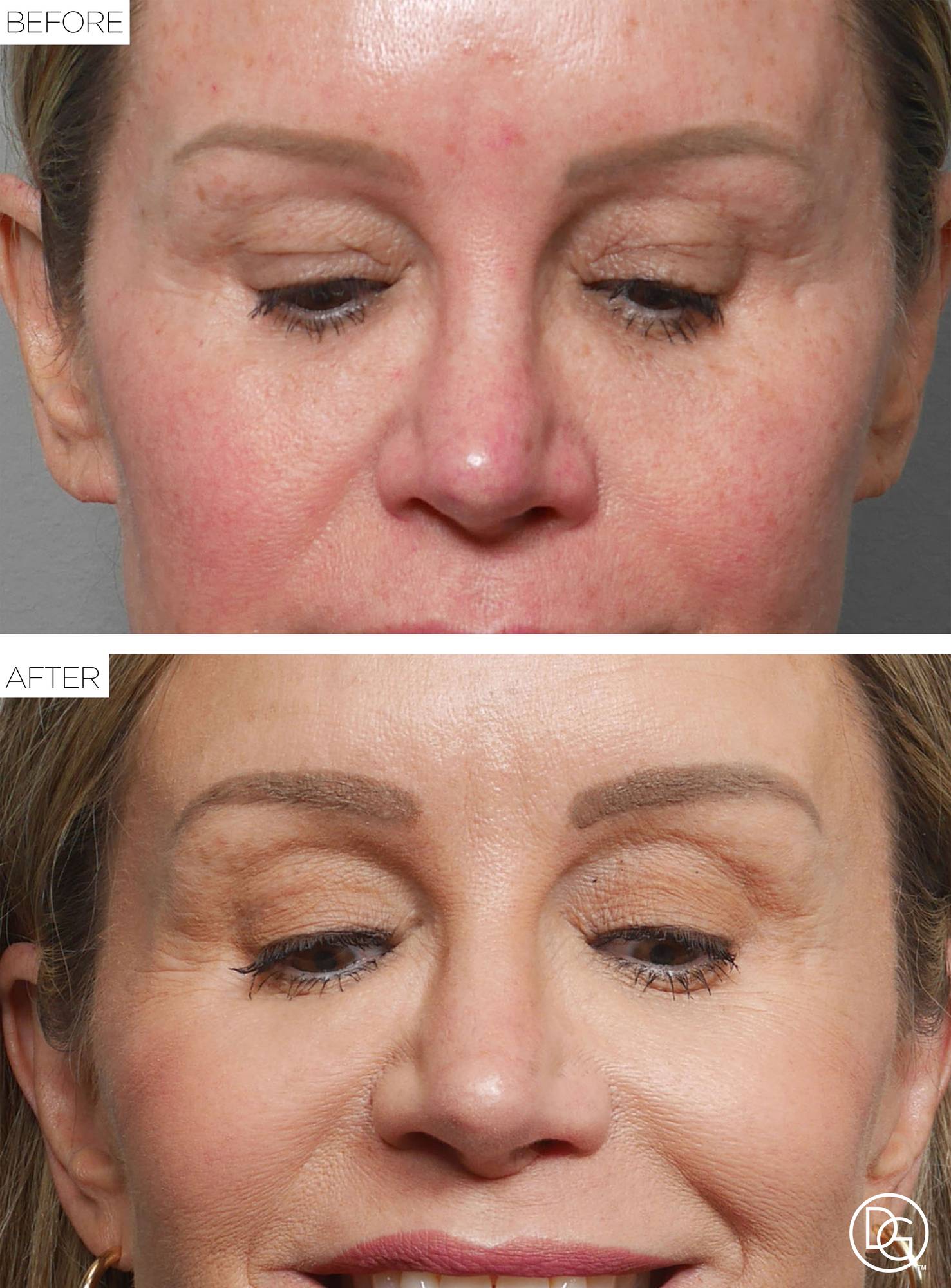 Before & After Image
