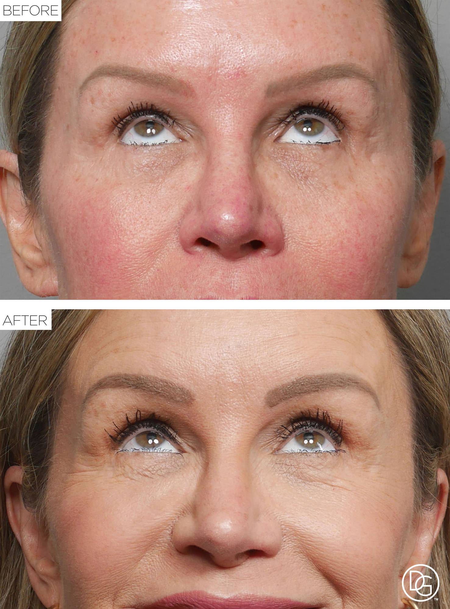 Before & After Image