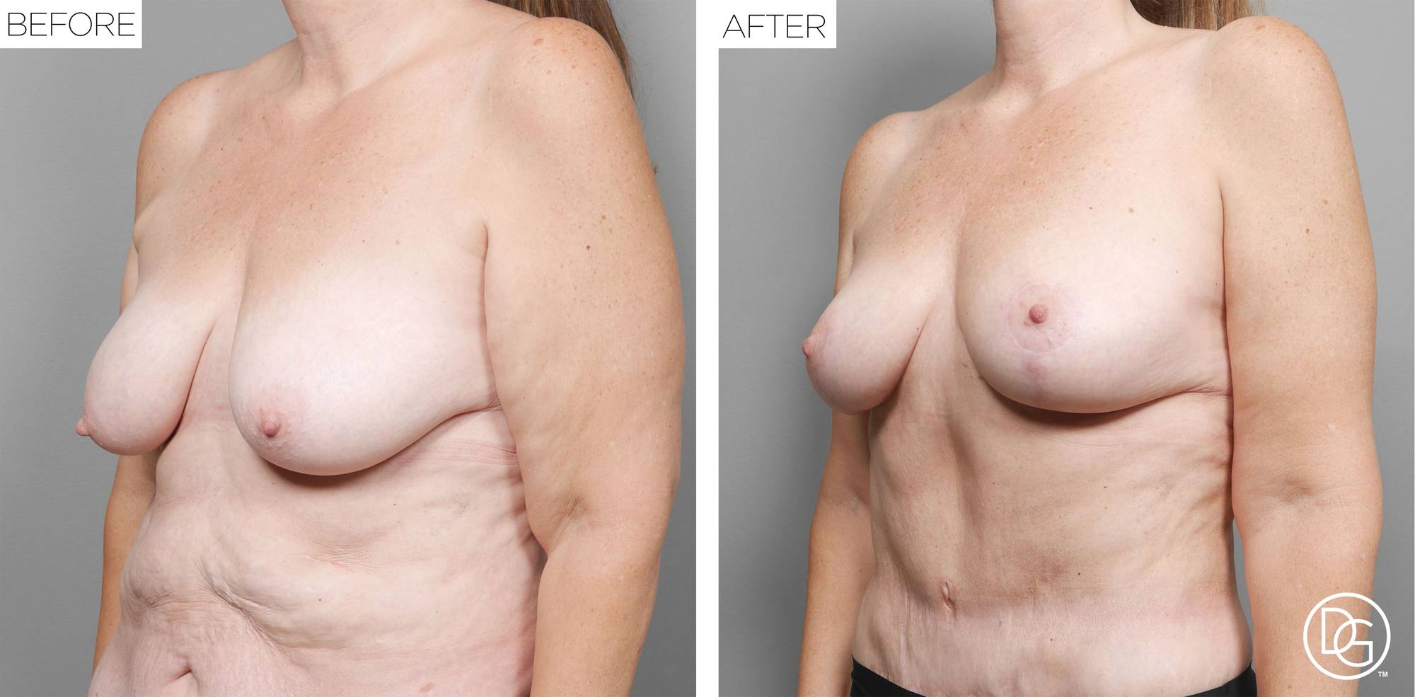 Before & After Image