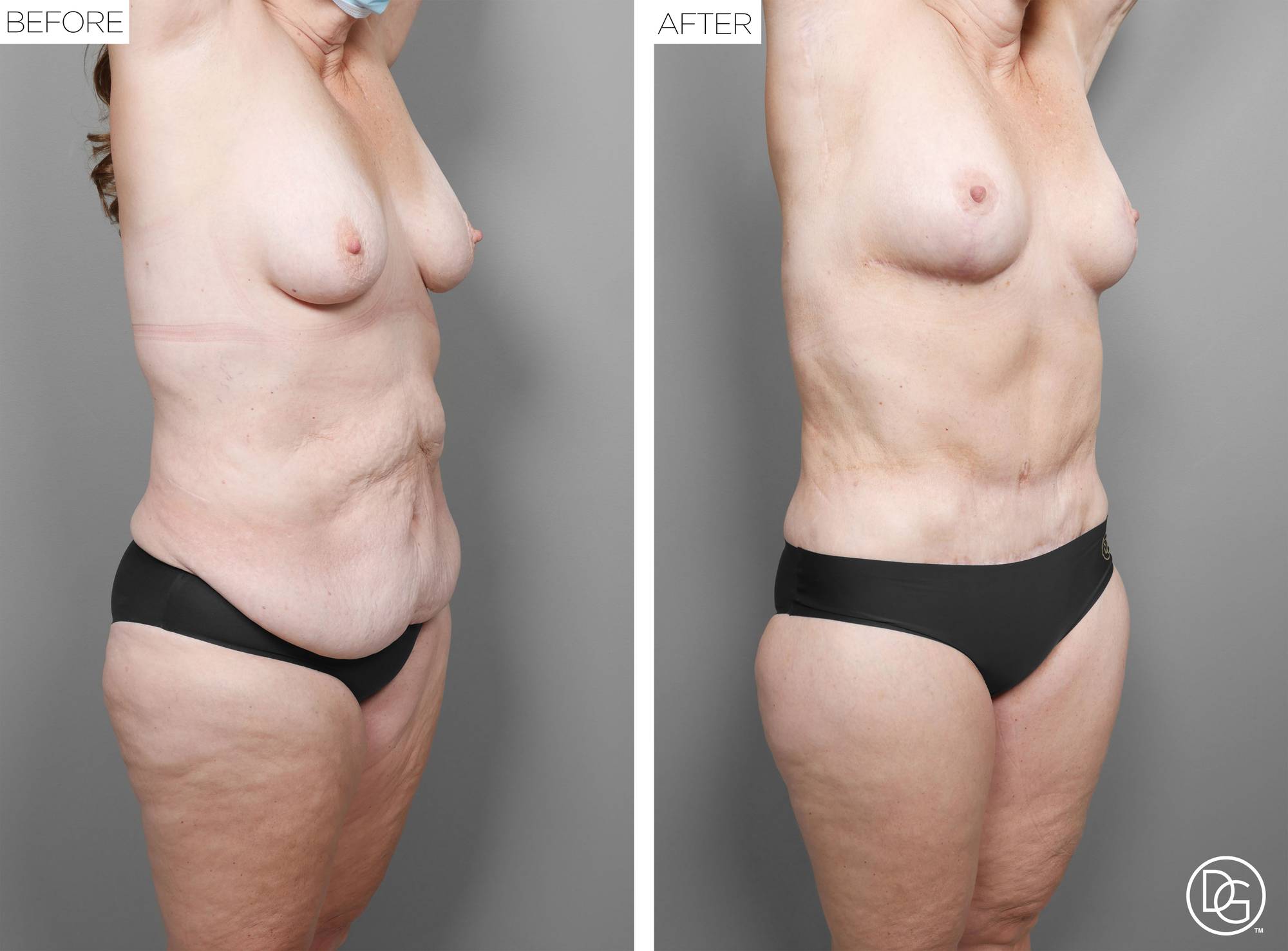 Before & After Image