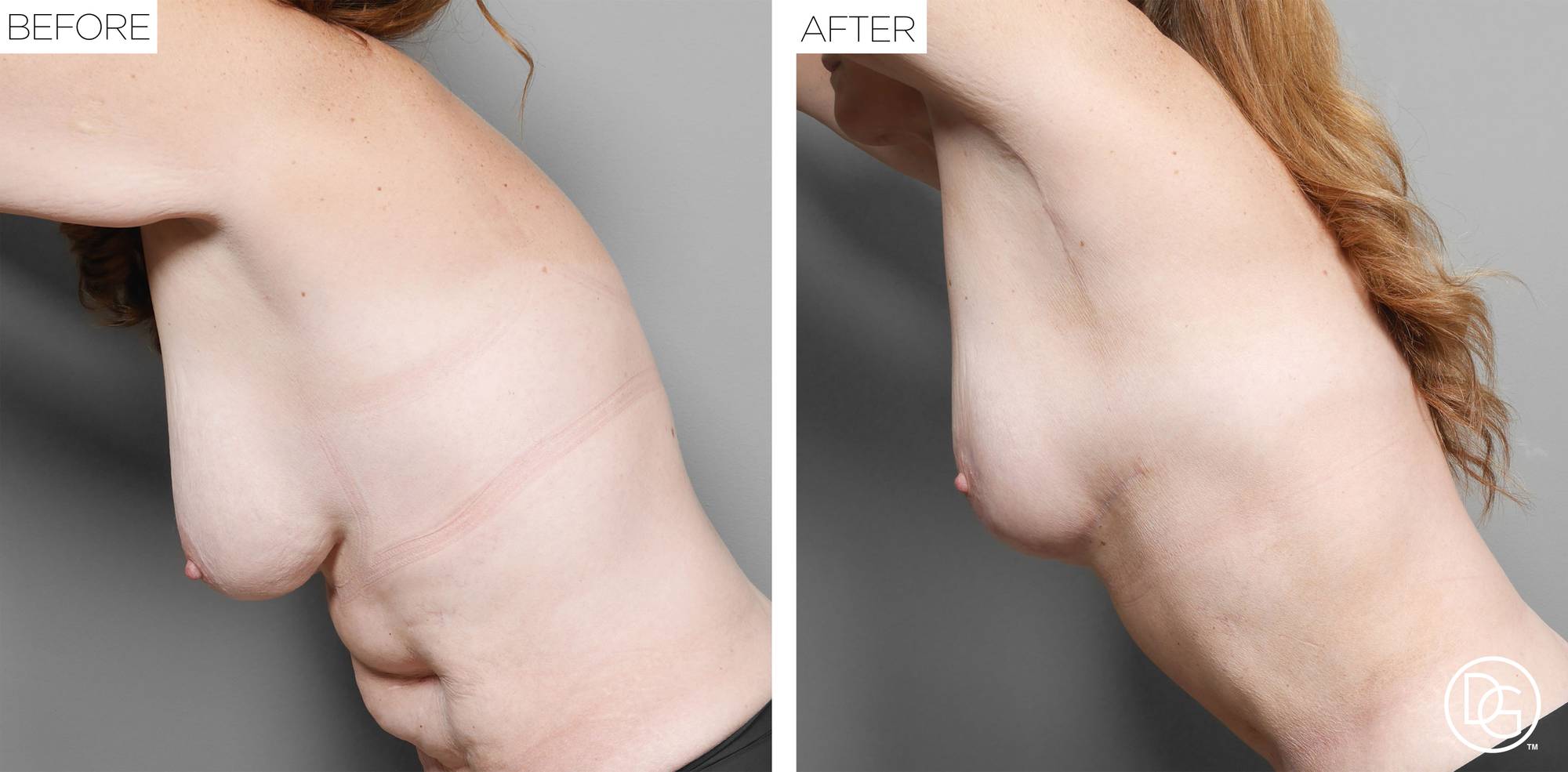 Before & After Image