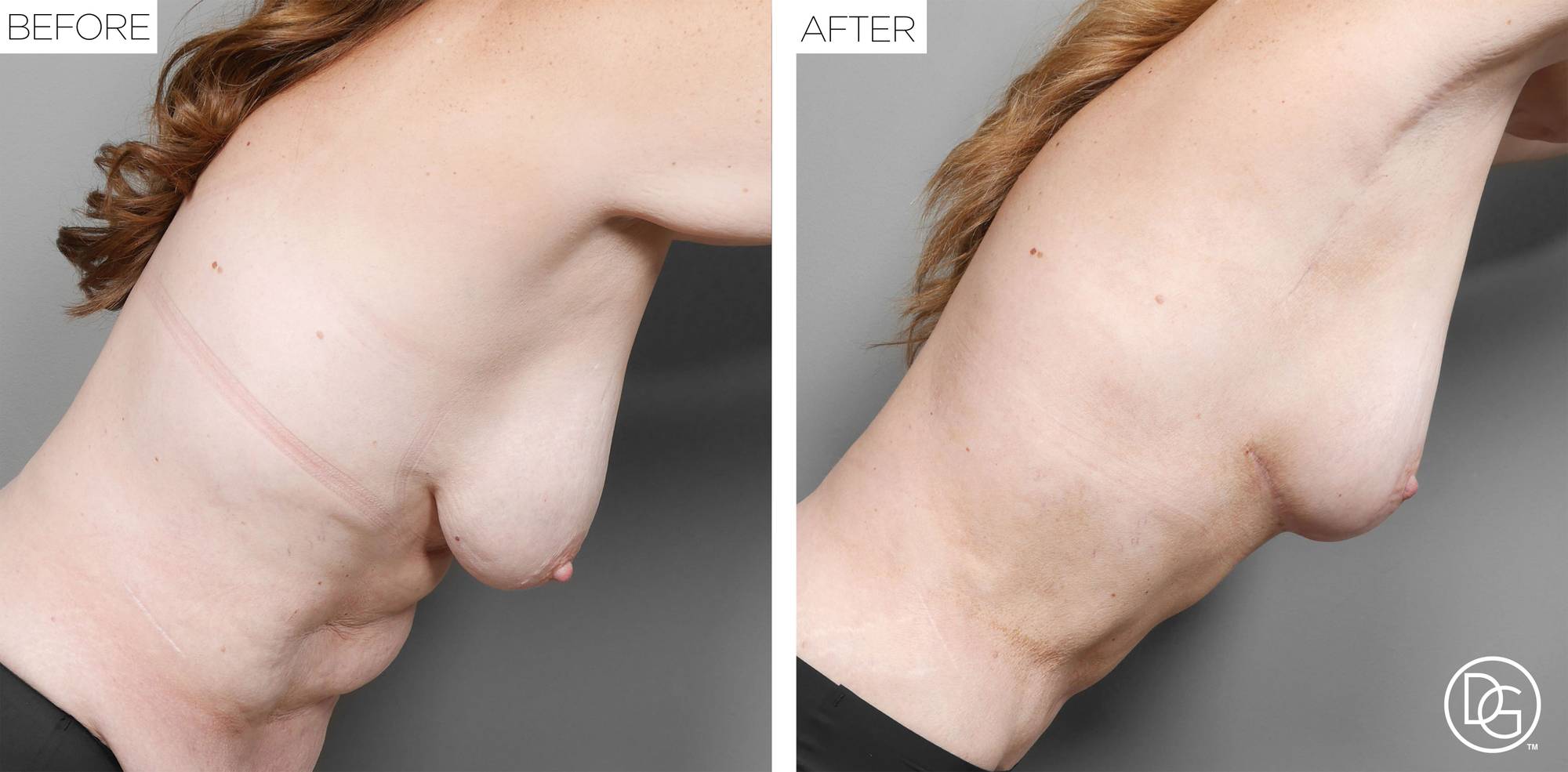 Before & After Image