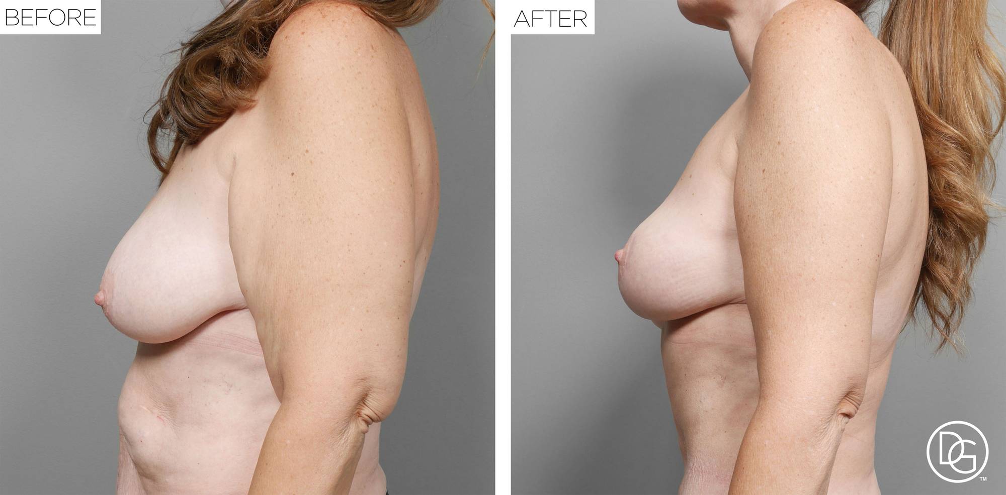 Before & After Image