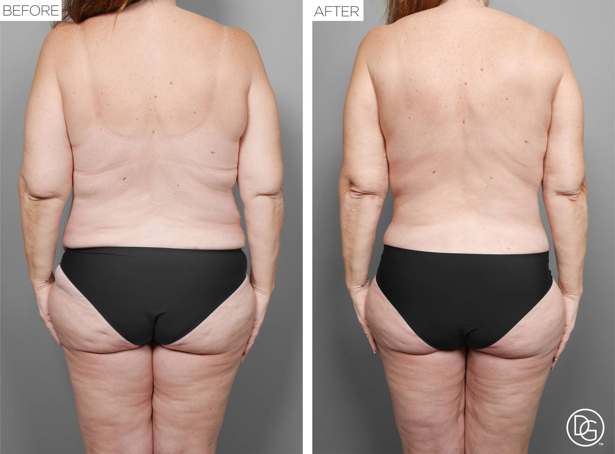 Before & After Image