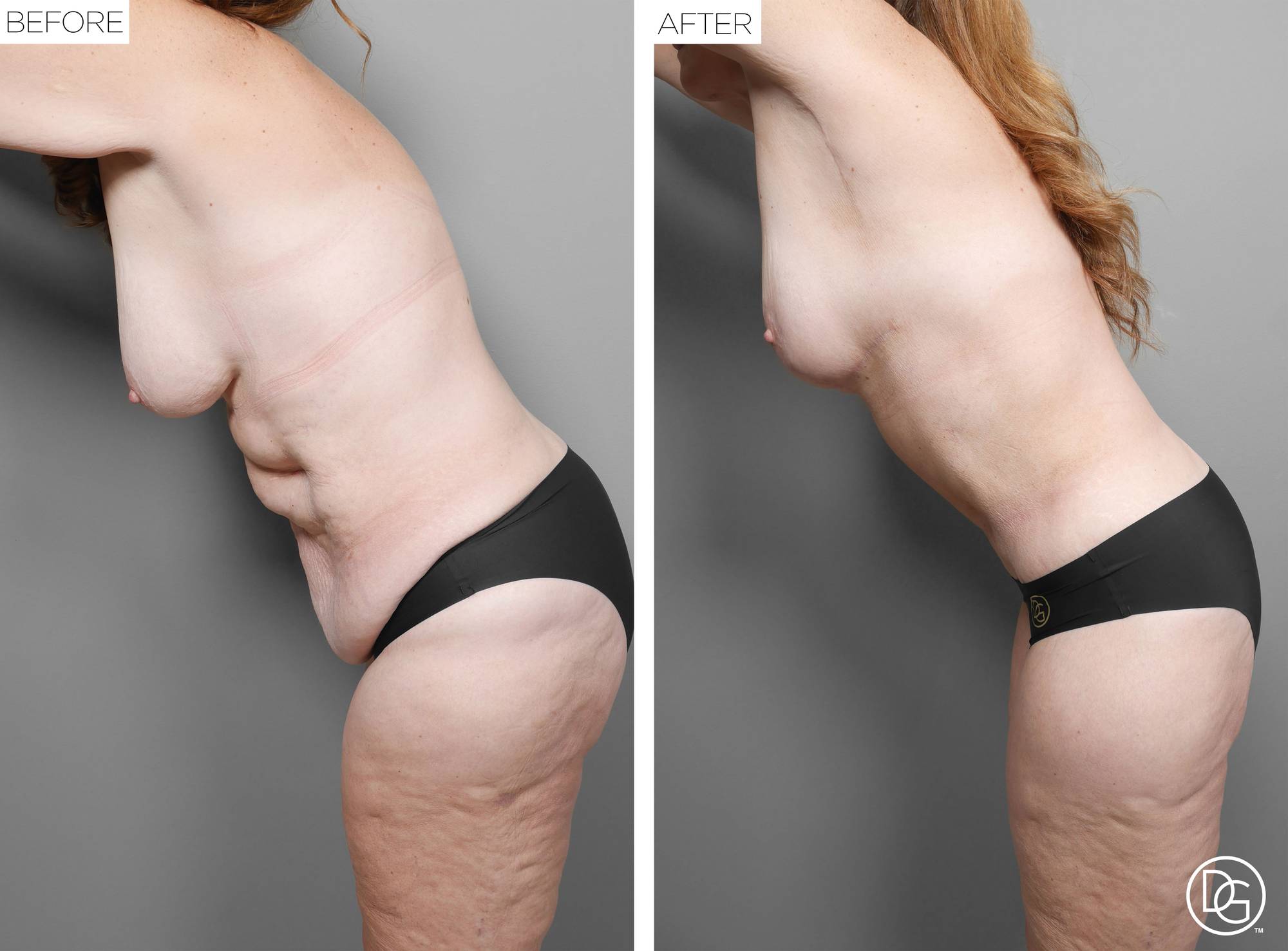 Before & After Image