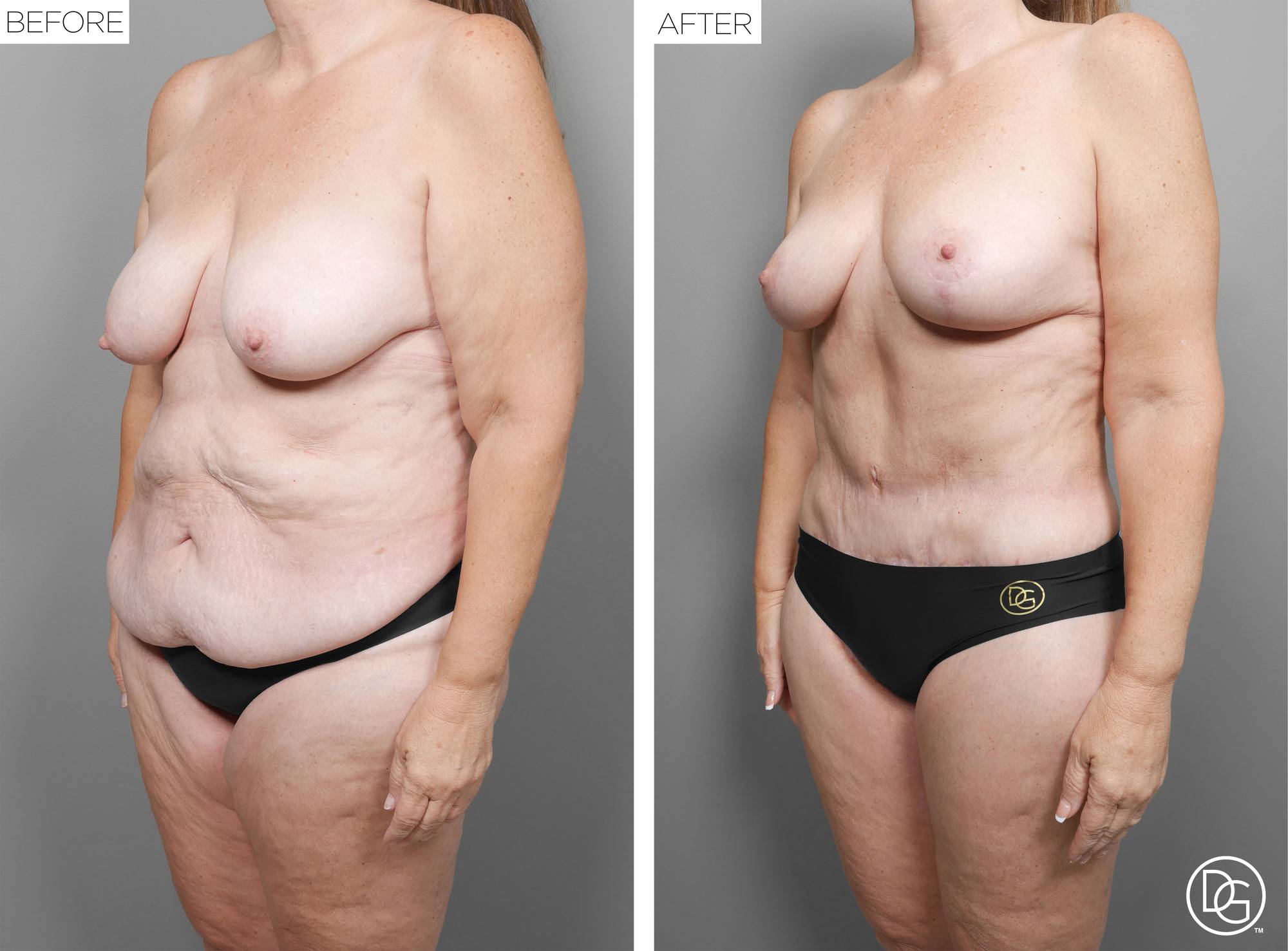 Before & After Image