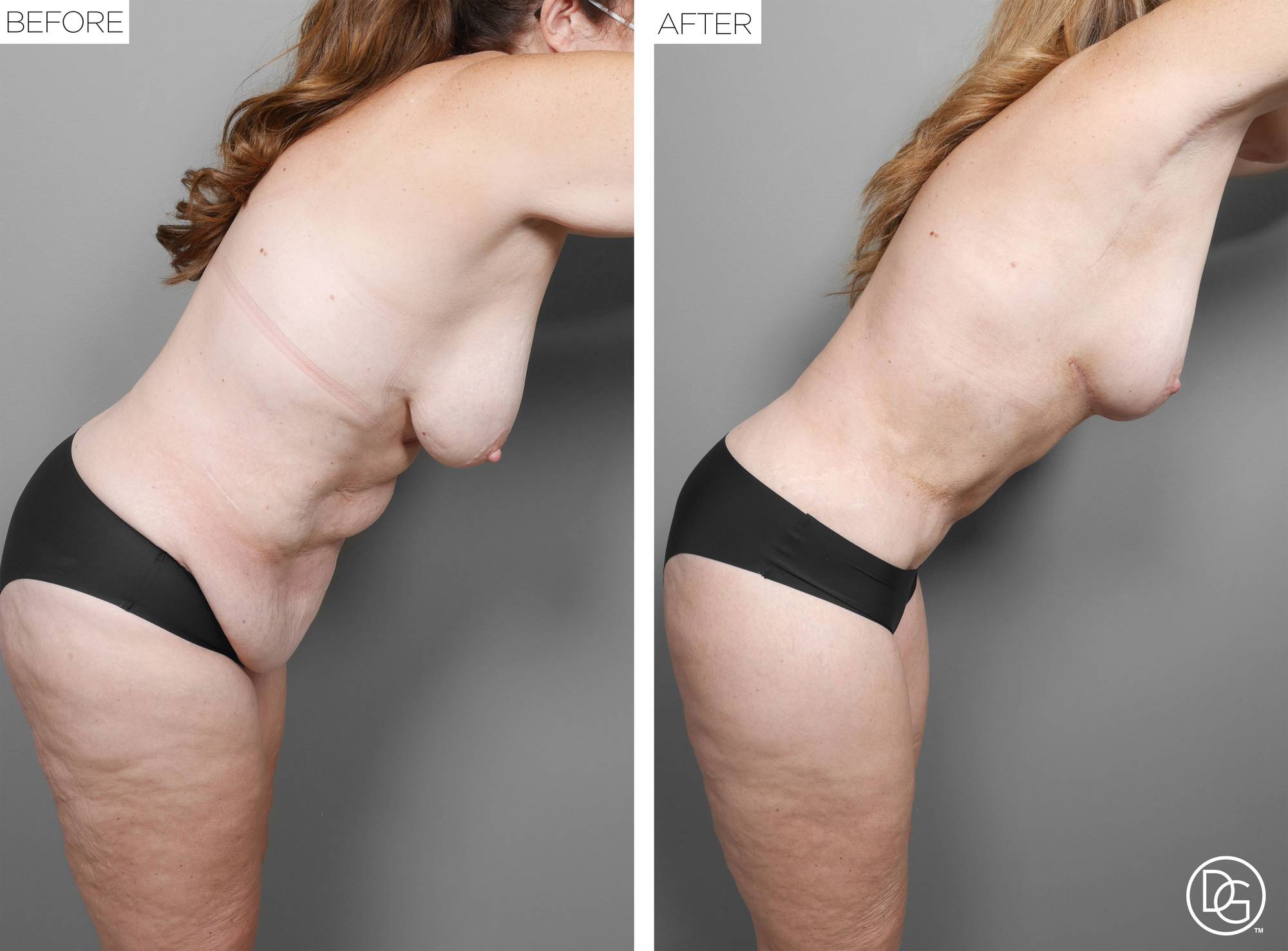 Before & After Image