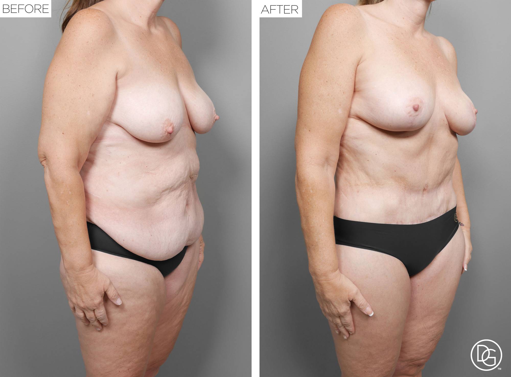 Before & After Image