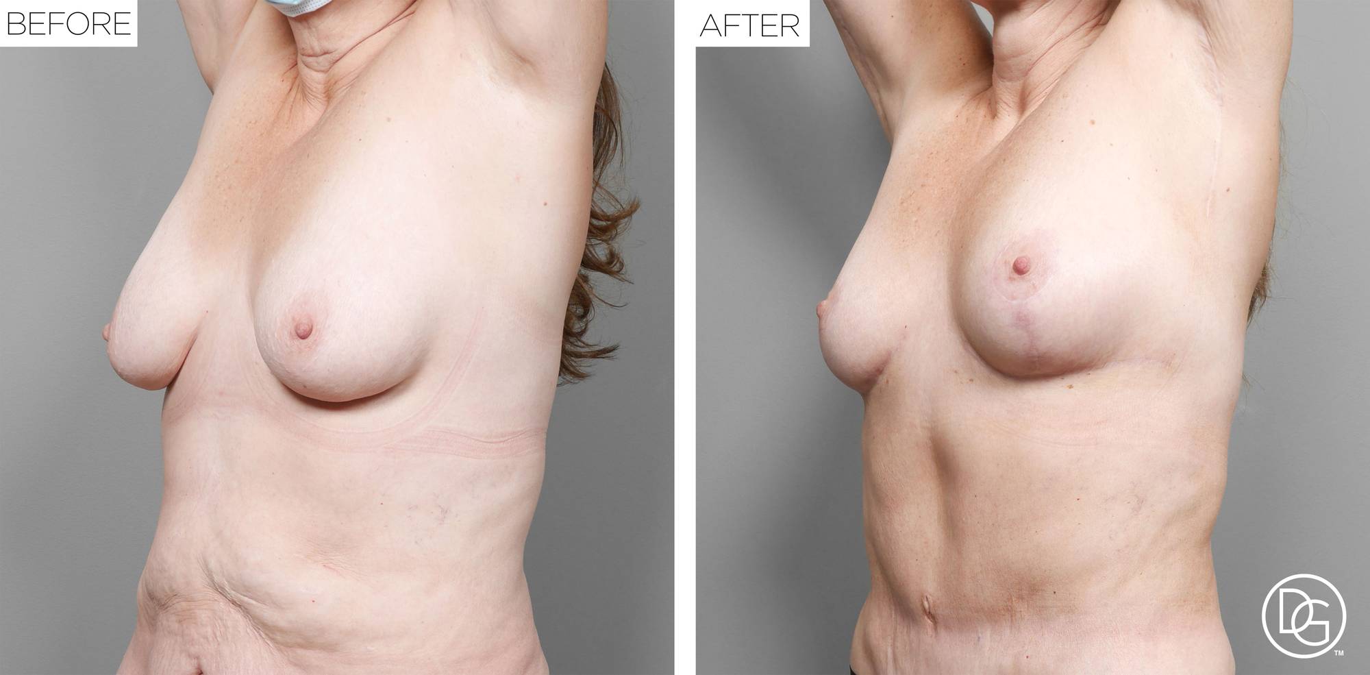 Before & After Image