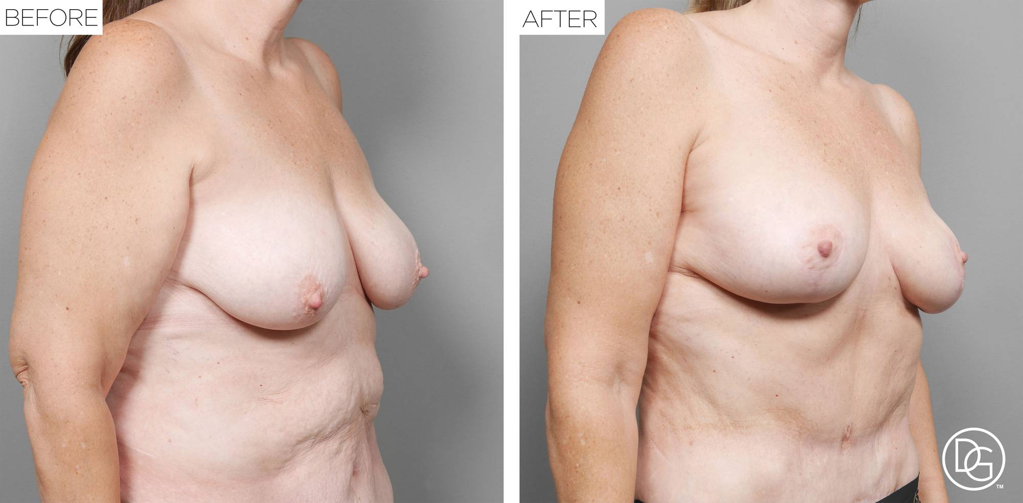 Before & After Image