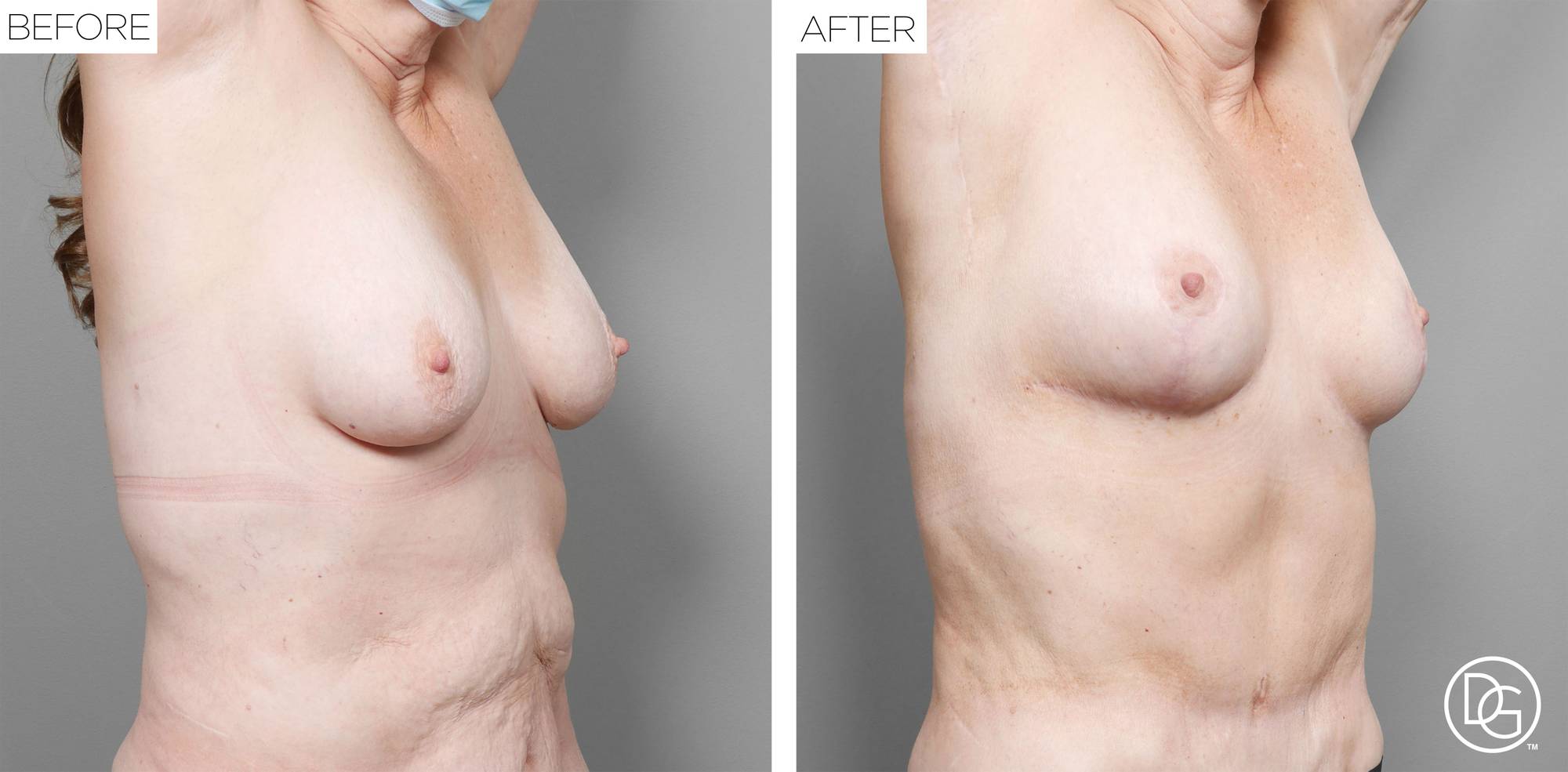 Before & After Image