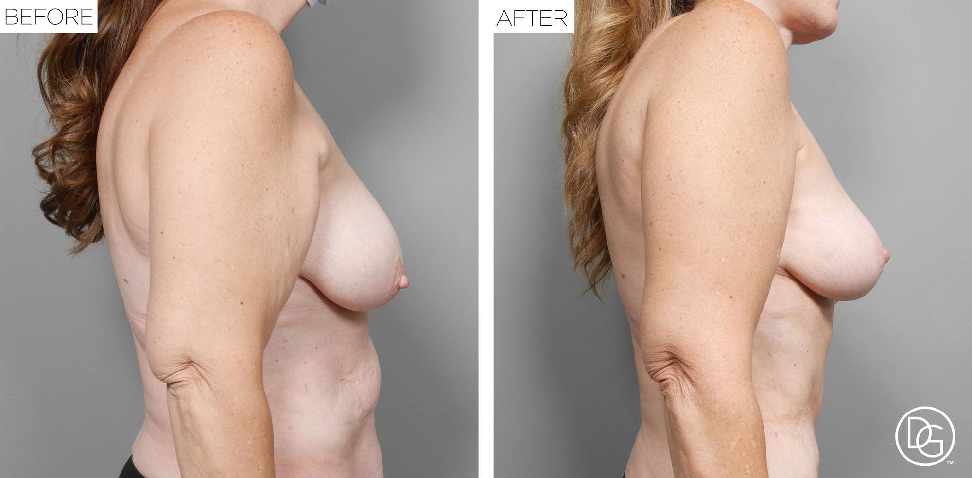 Before & After Image