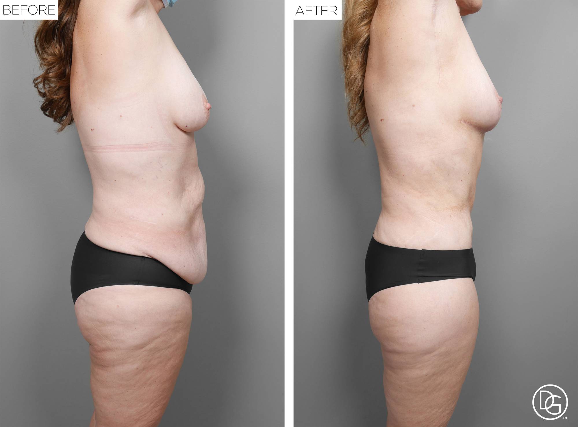 Before & After Image