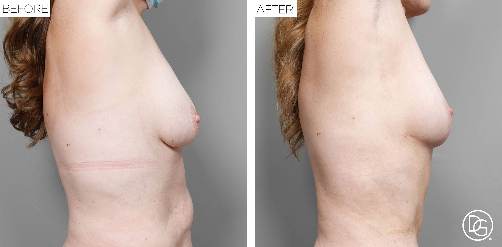 Before & After Image