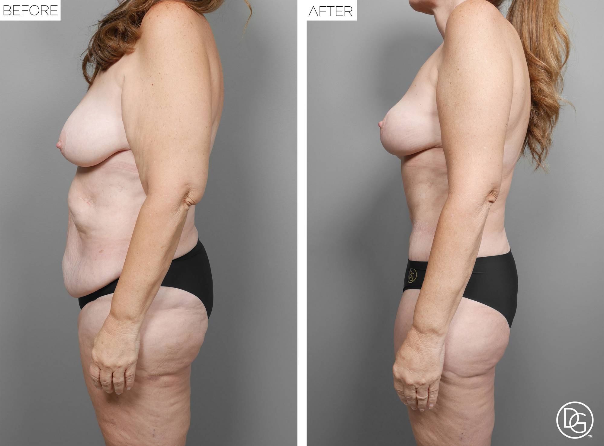 Before & After Image
