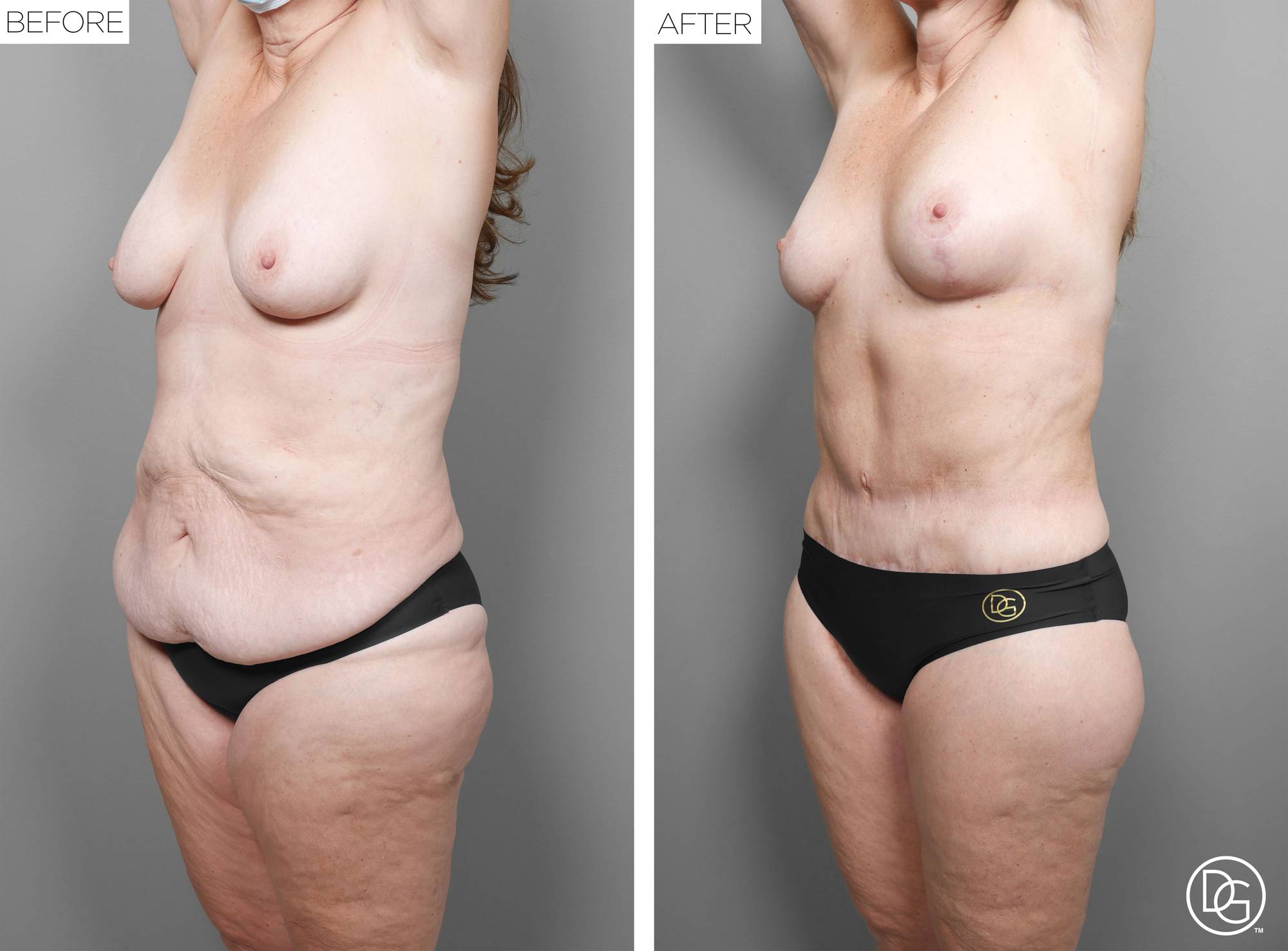 Before & After Image