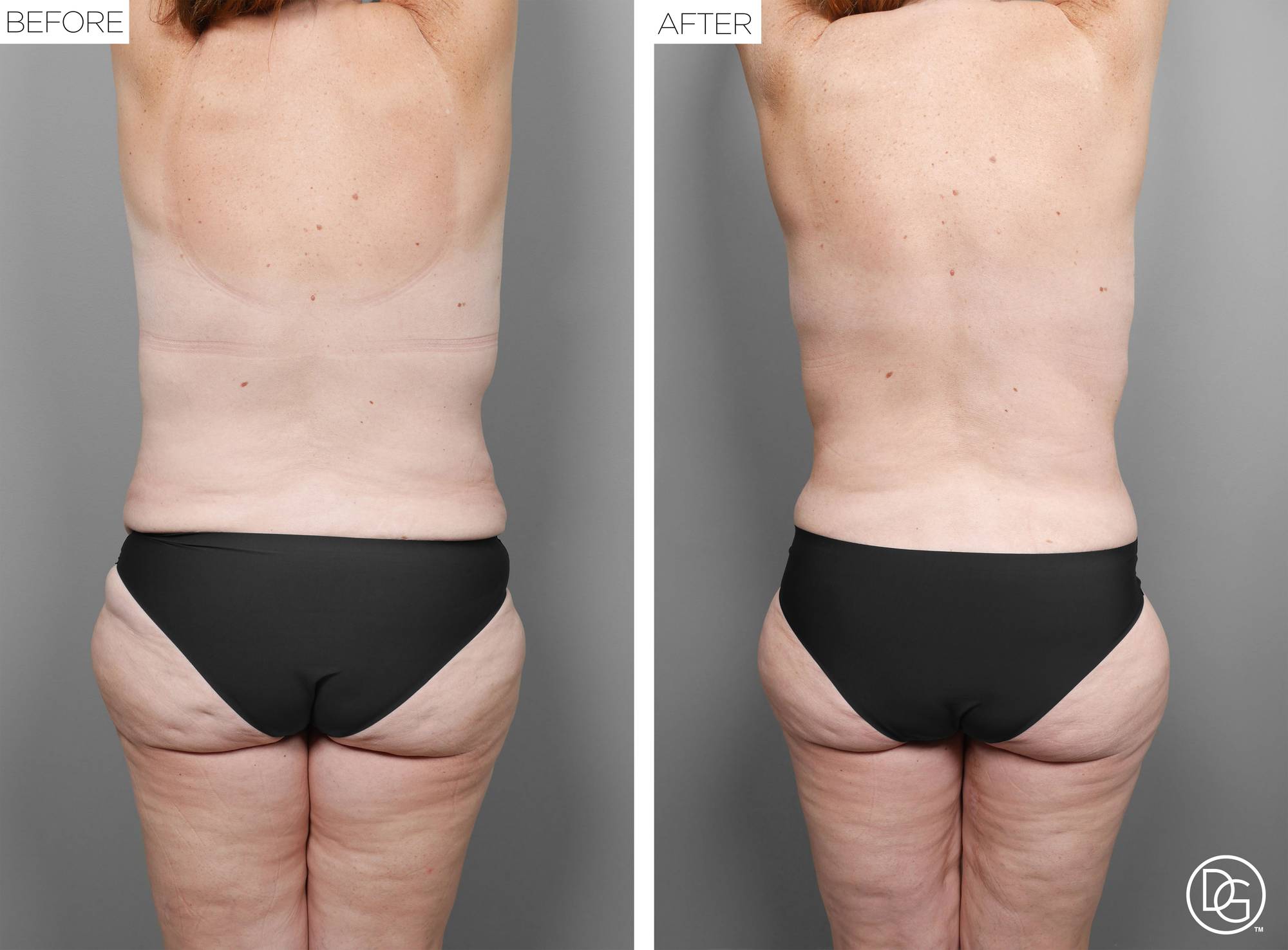 Before & After Image