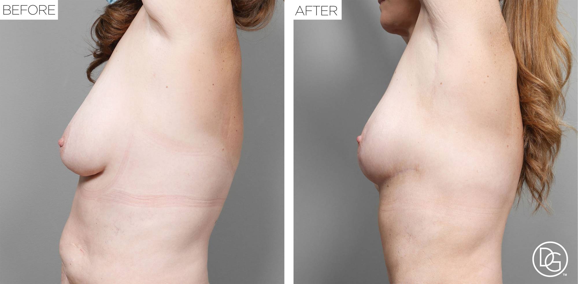 Before & After Image