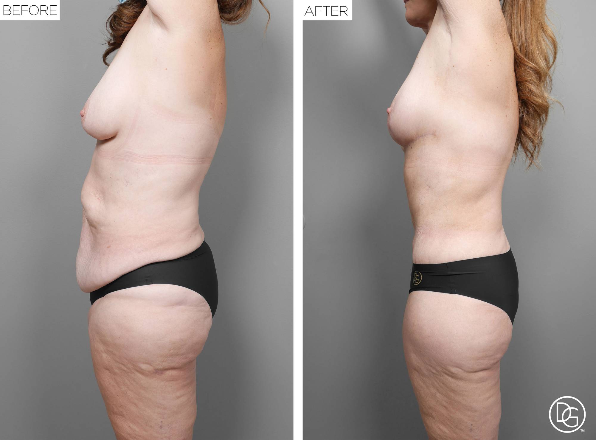 Before & After Image