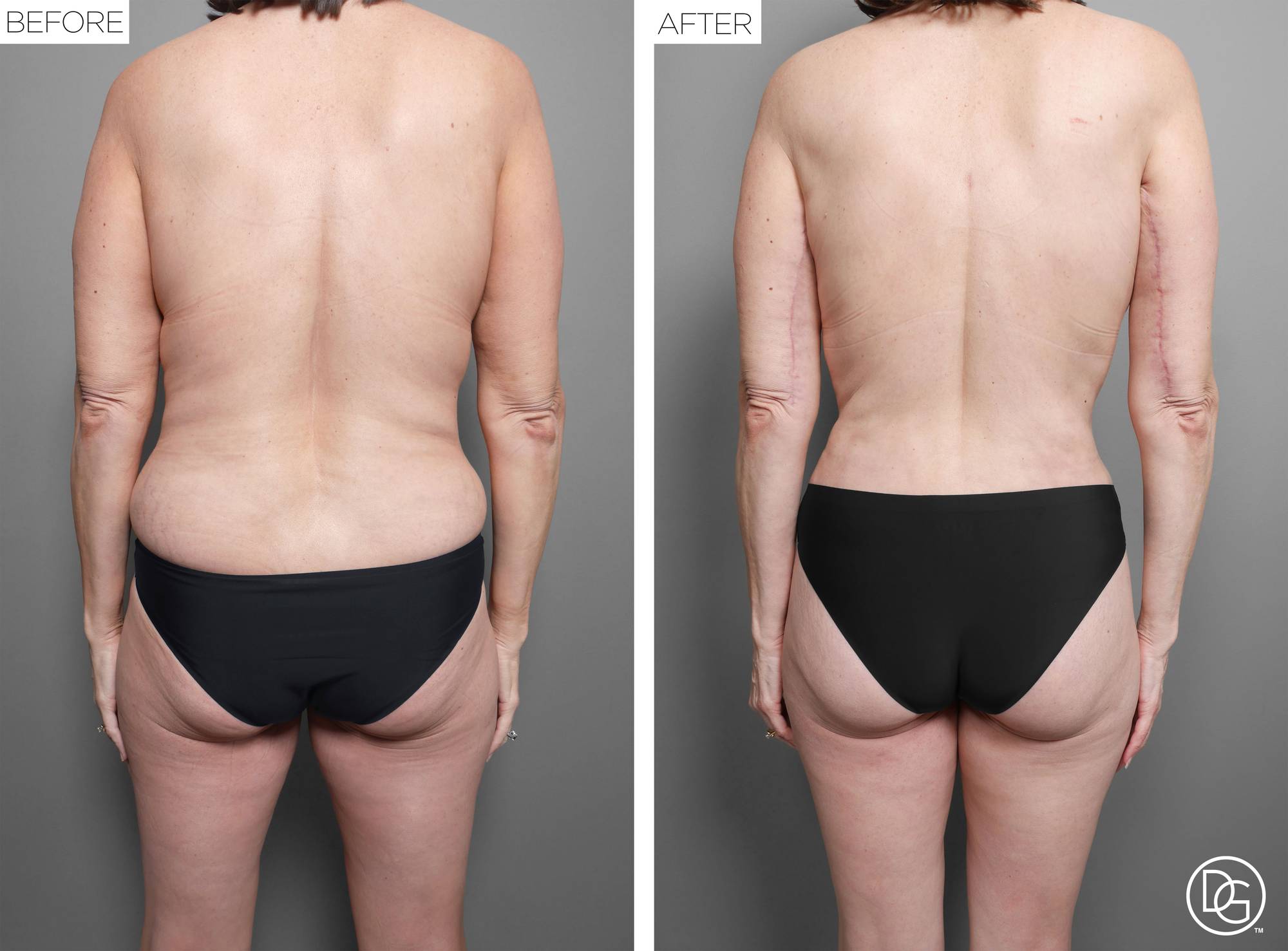 Before & After Image