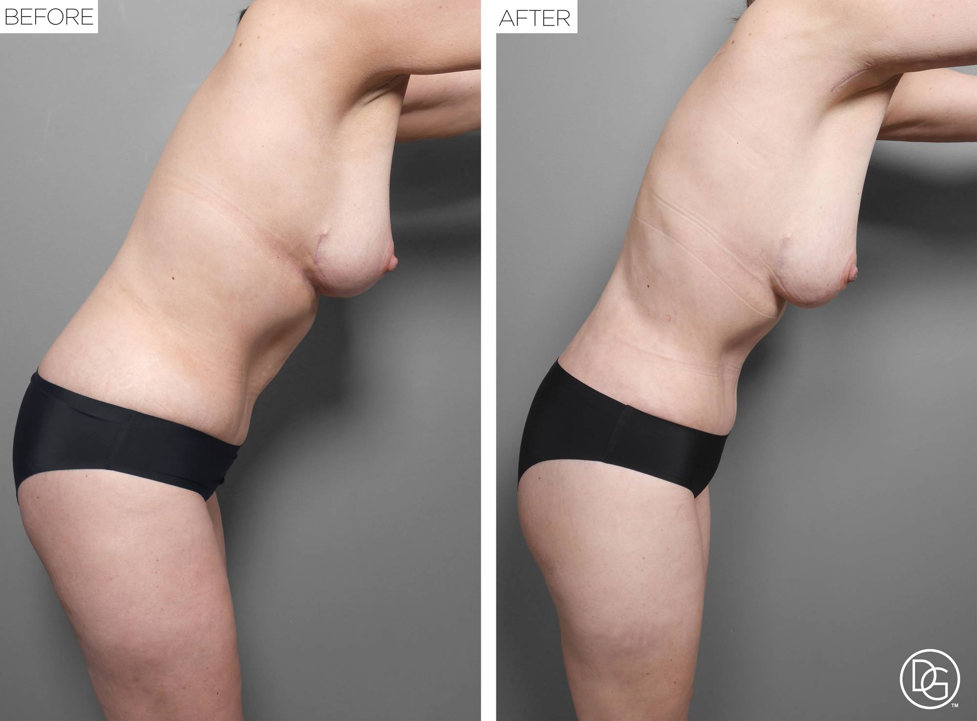 Before & After Image
