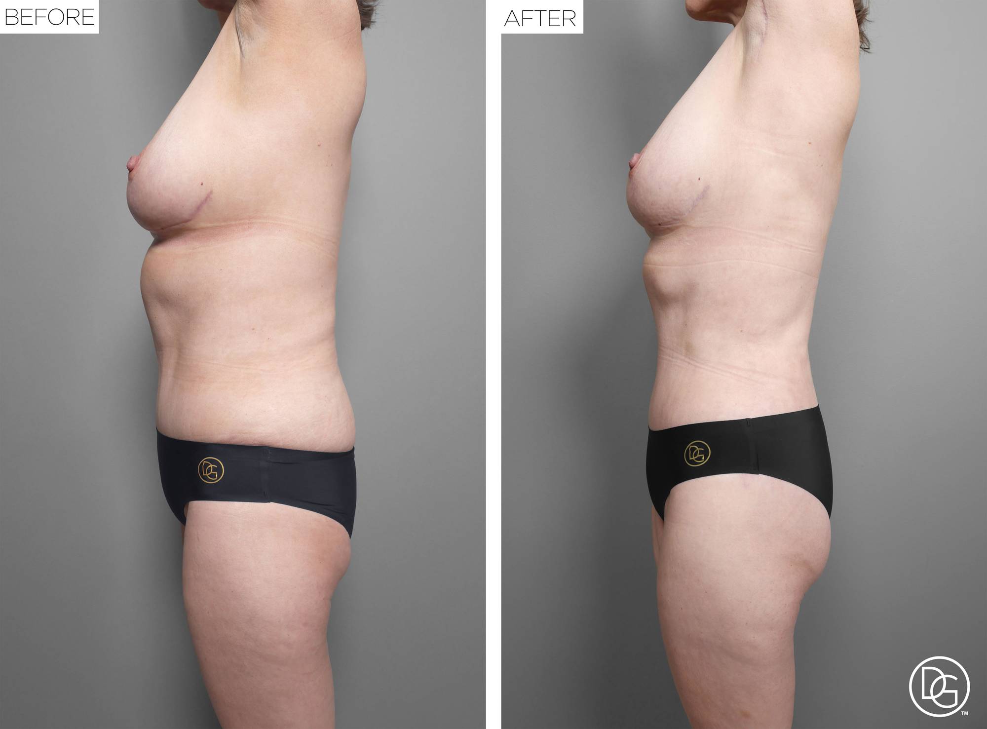 Before & After Image