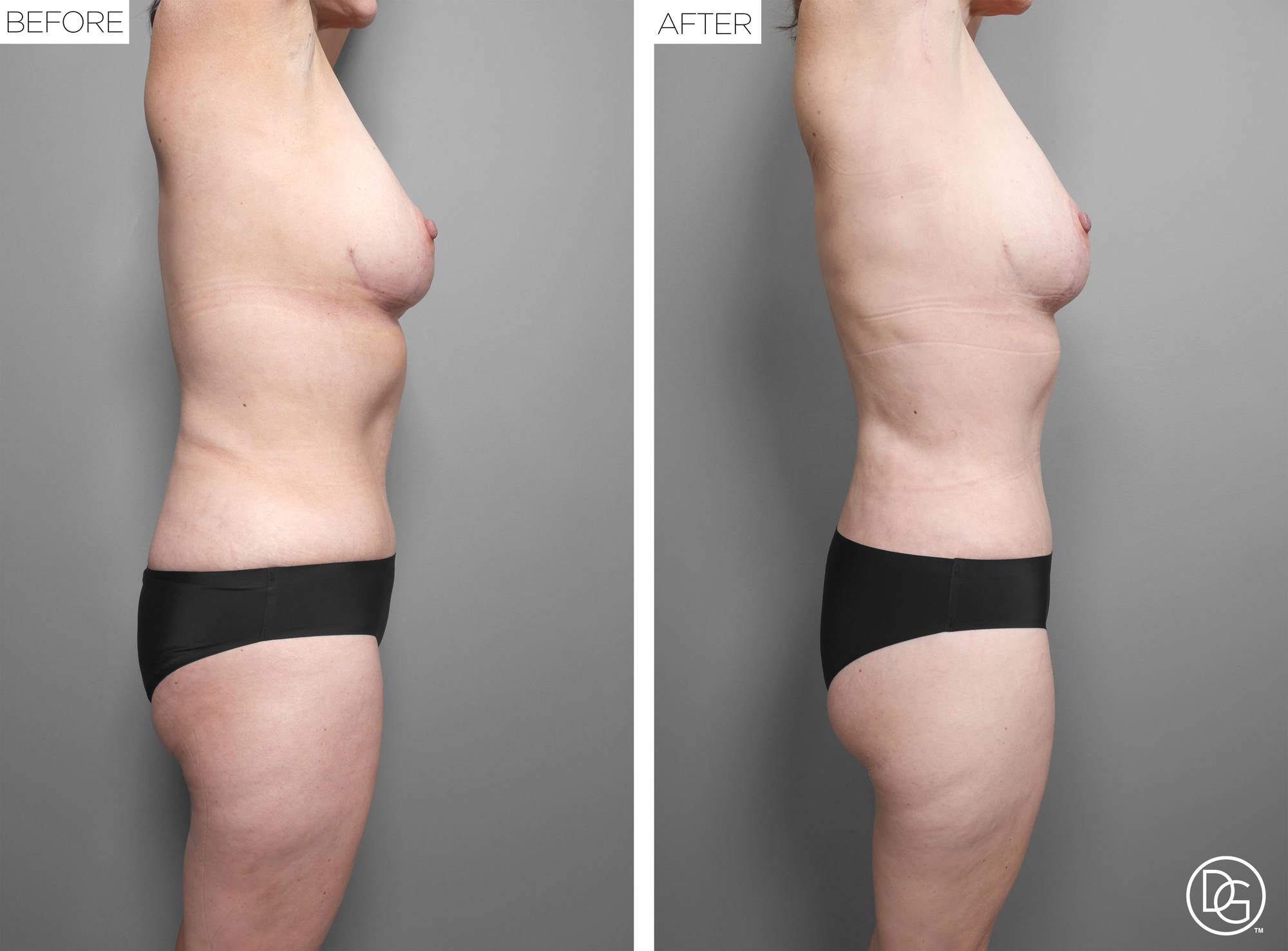Before & After Image