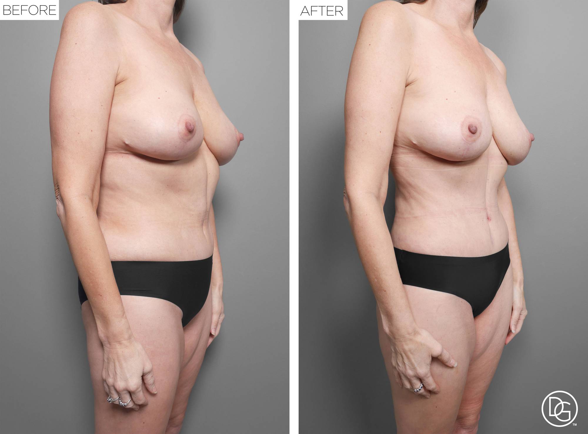 Before & After Image