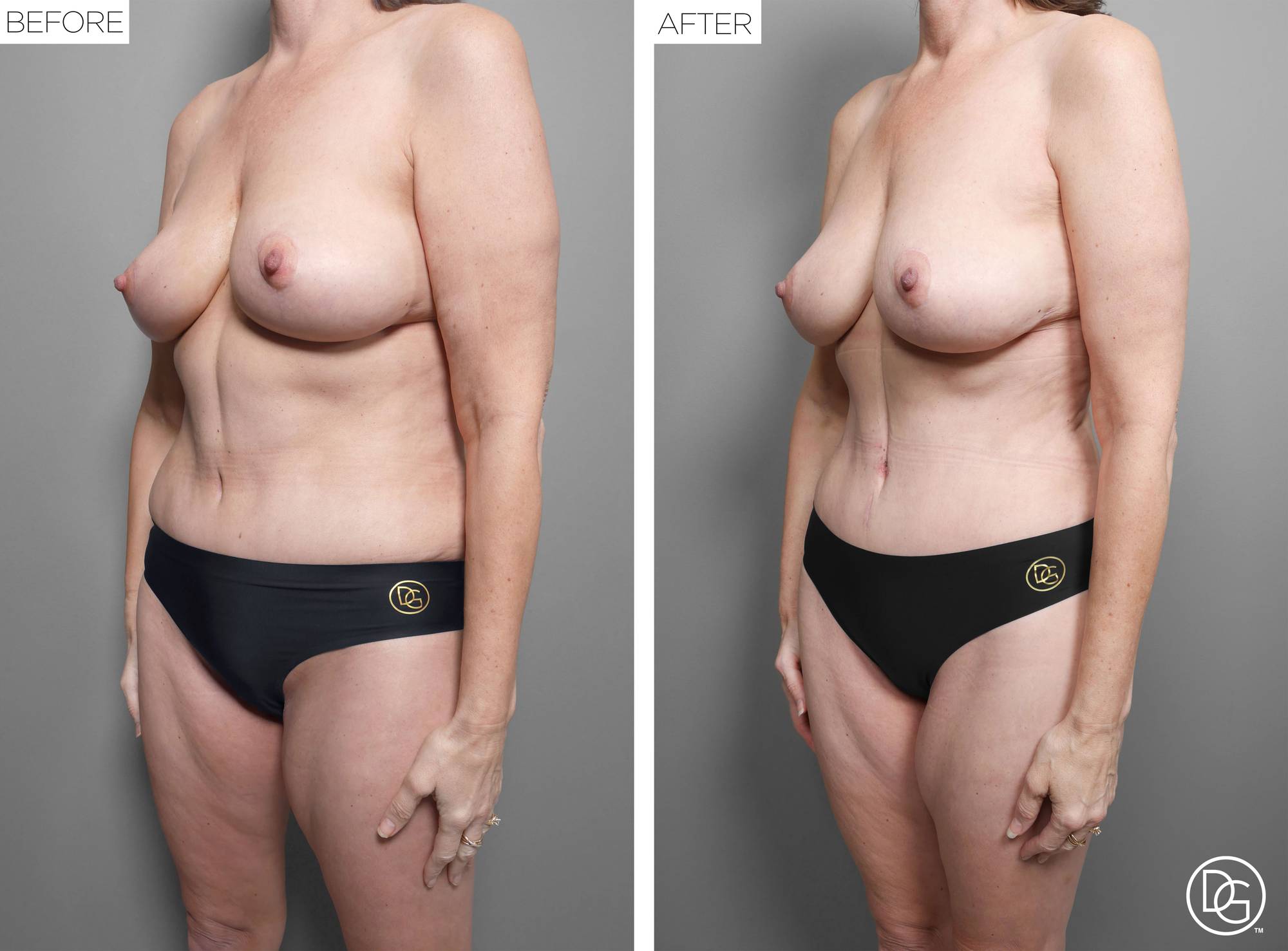 Before & After Image