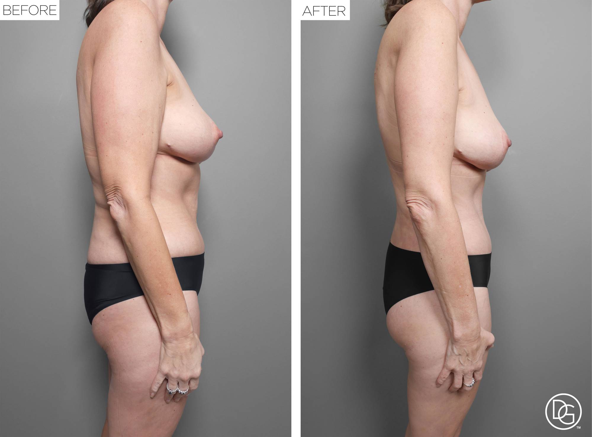 Before & After Image