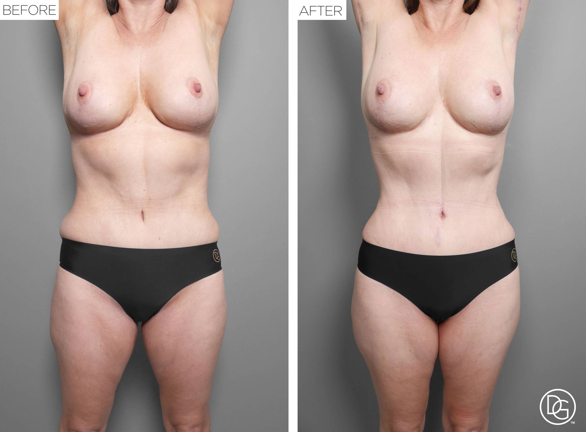 Before & After Image