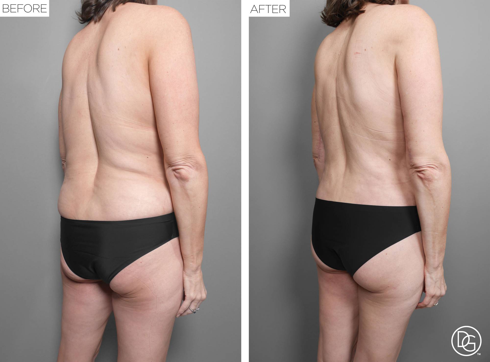 Before & After Image