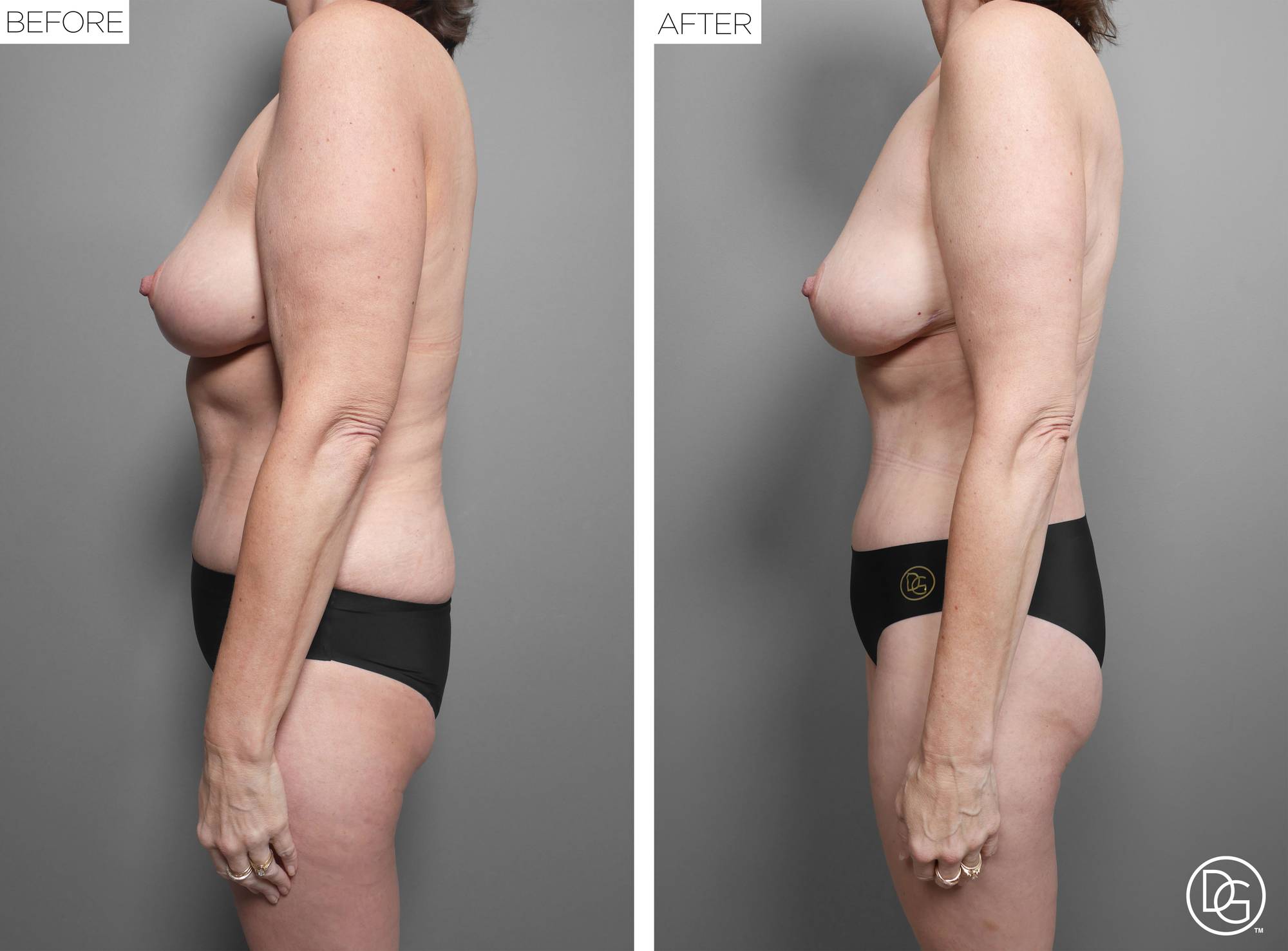 Before & After Image
