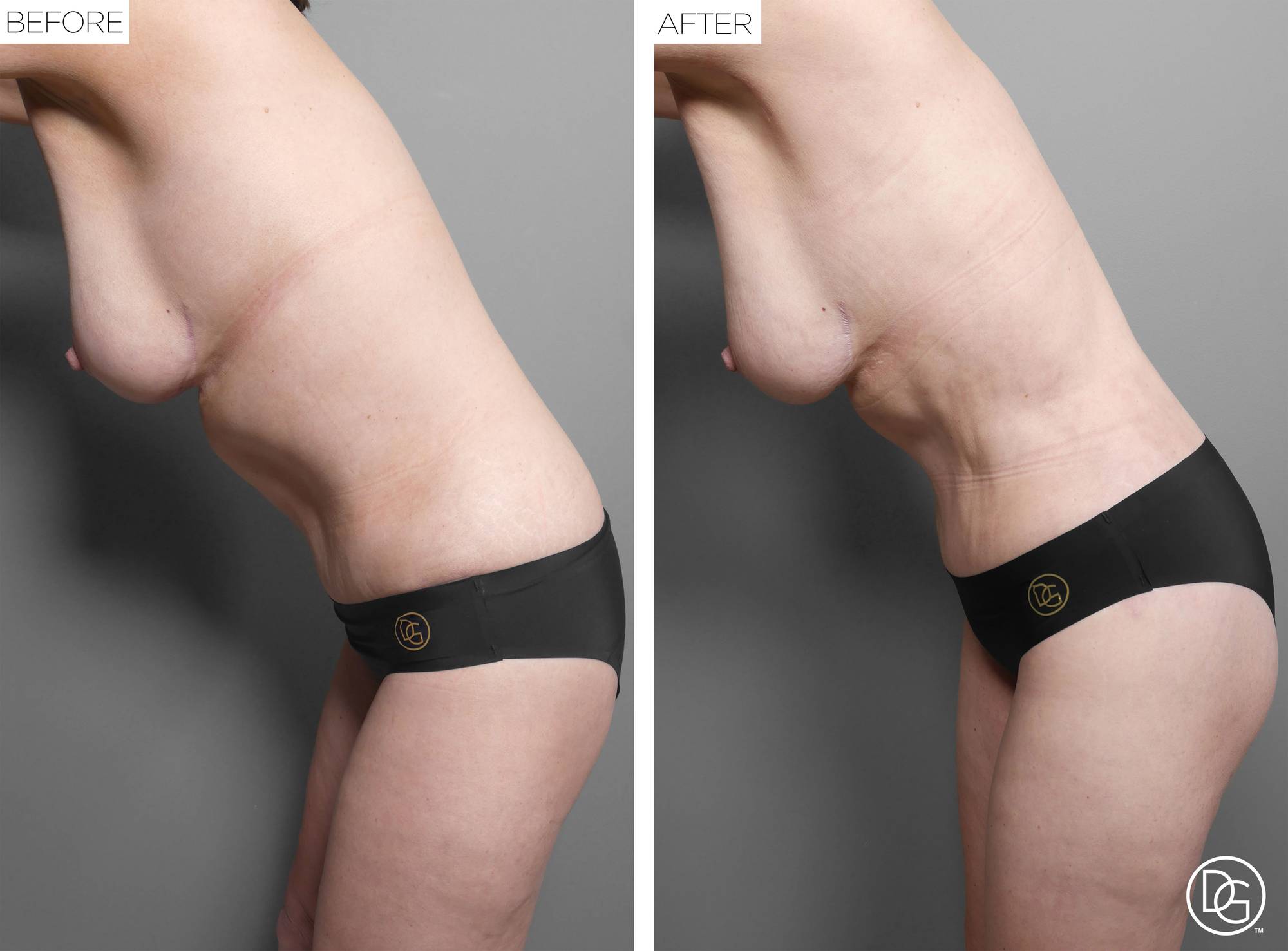 Before & After Image