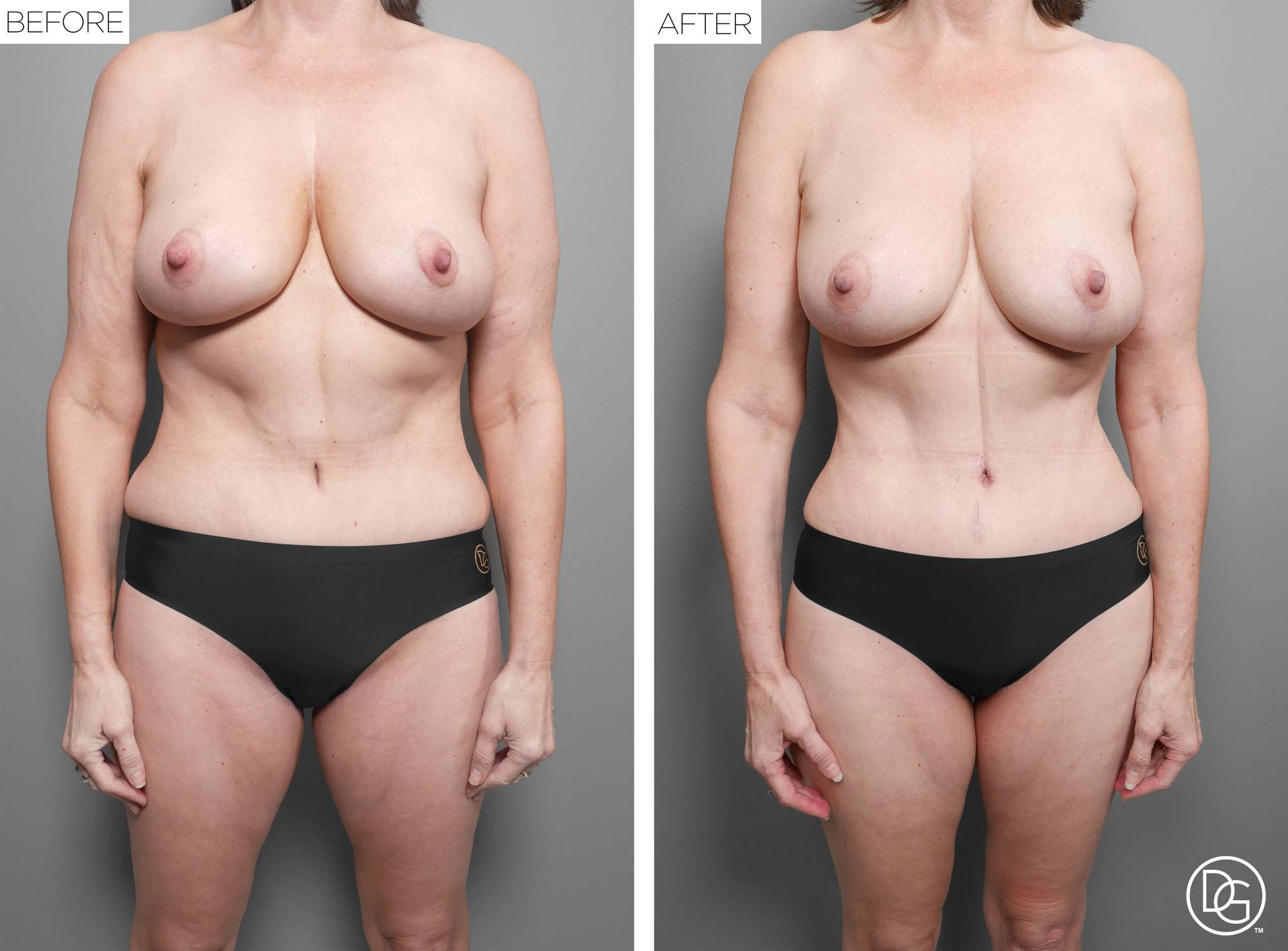 Before & After Image