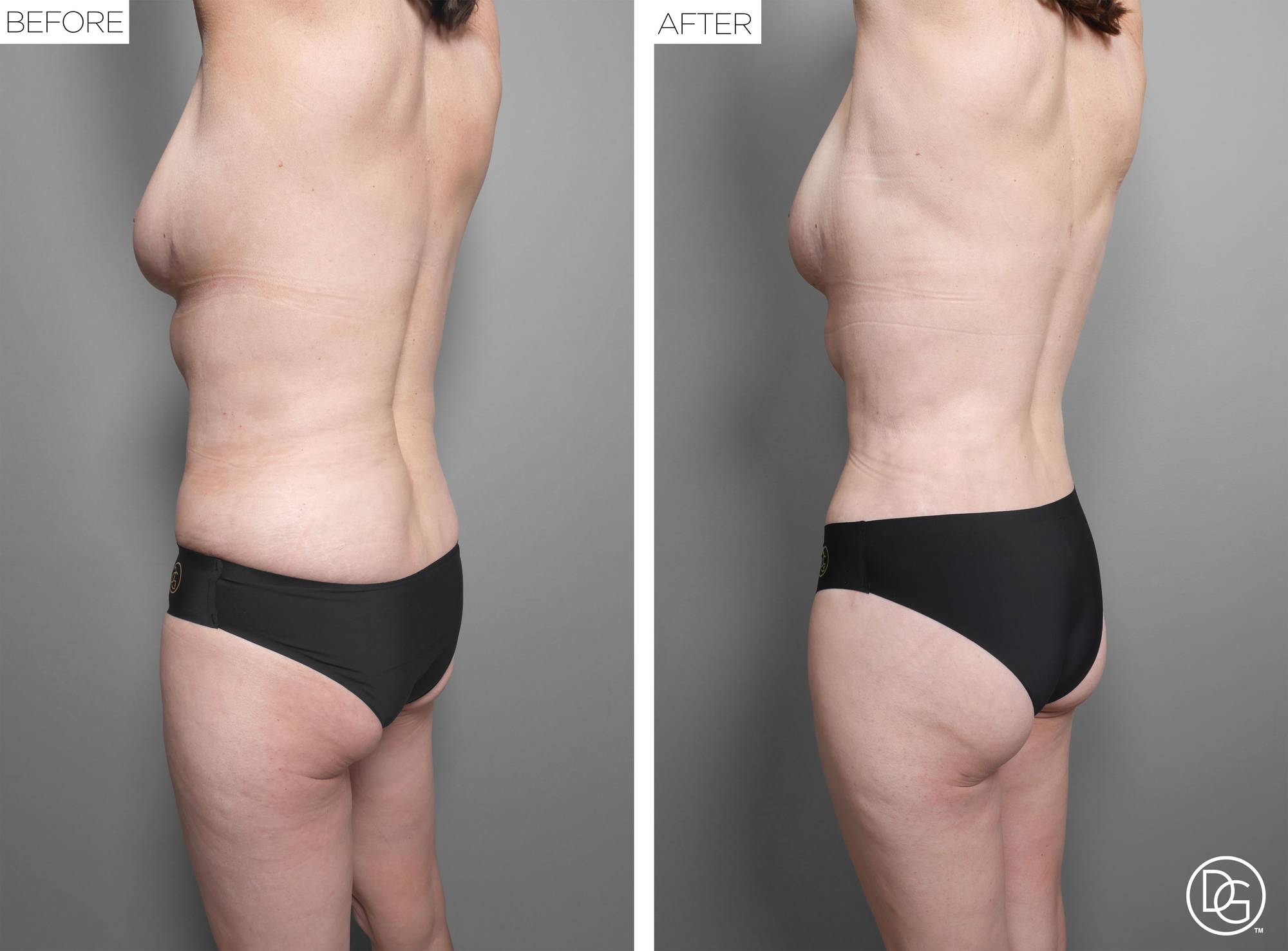 Before & After Image